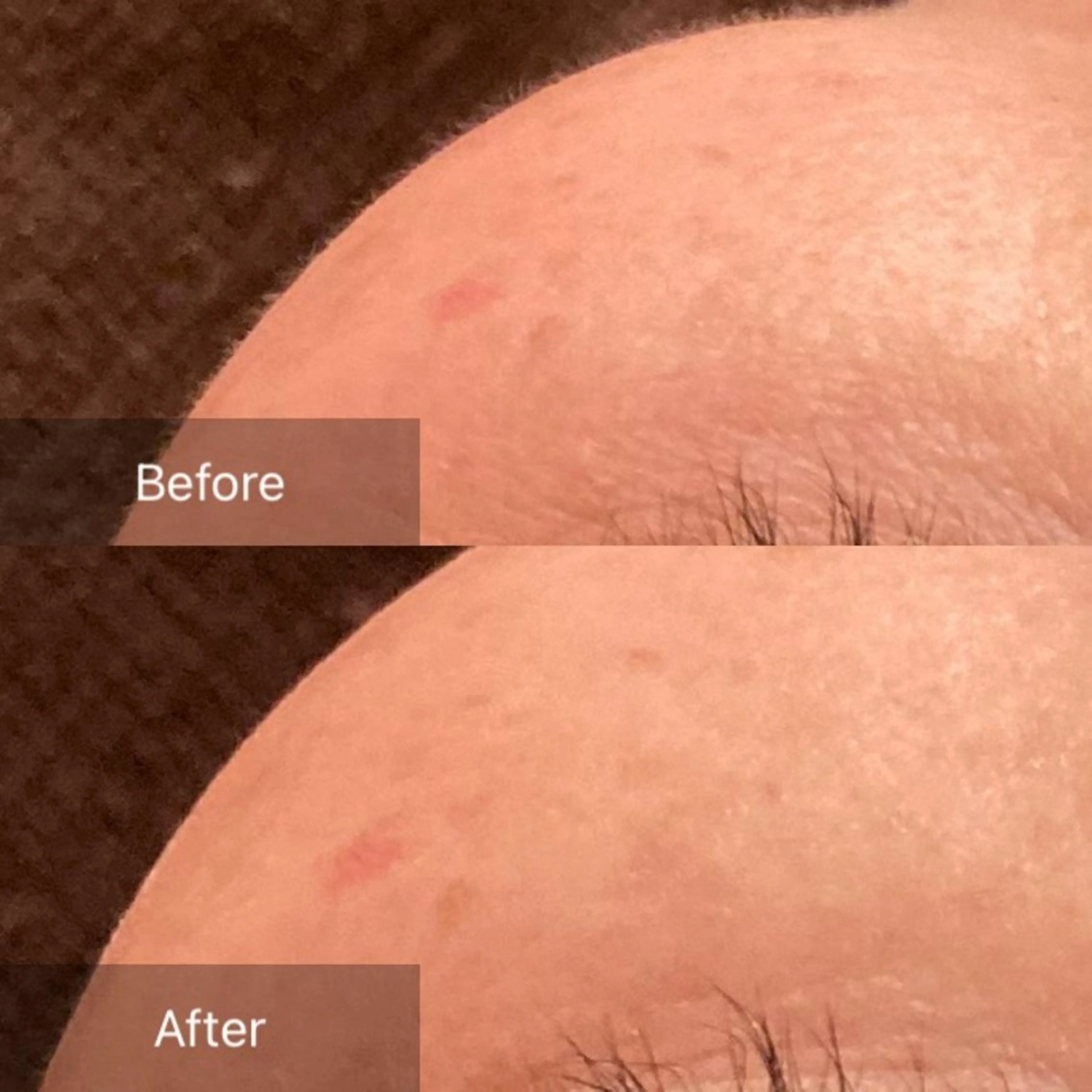 エステ 産毛専門店 Bittoのエステ・リラクイメージ