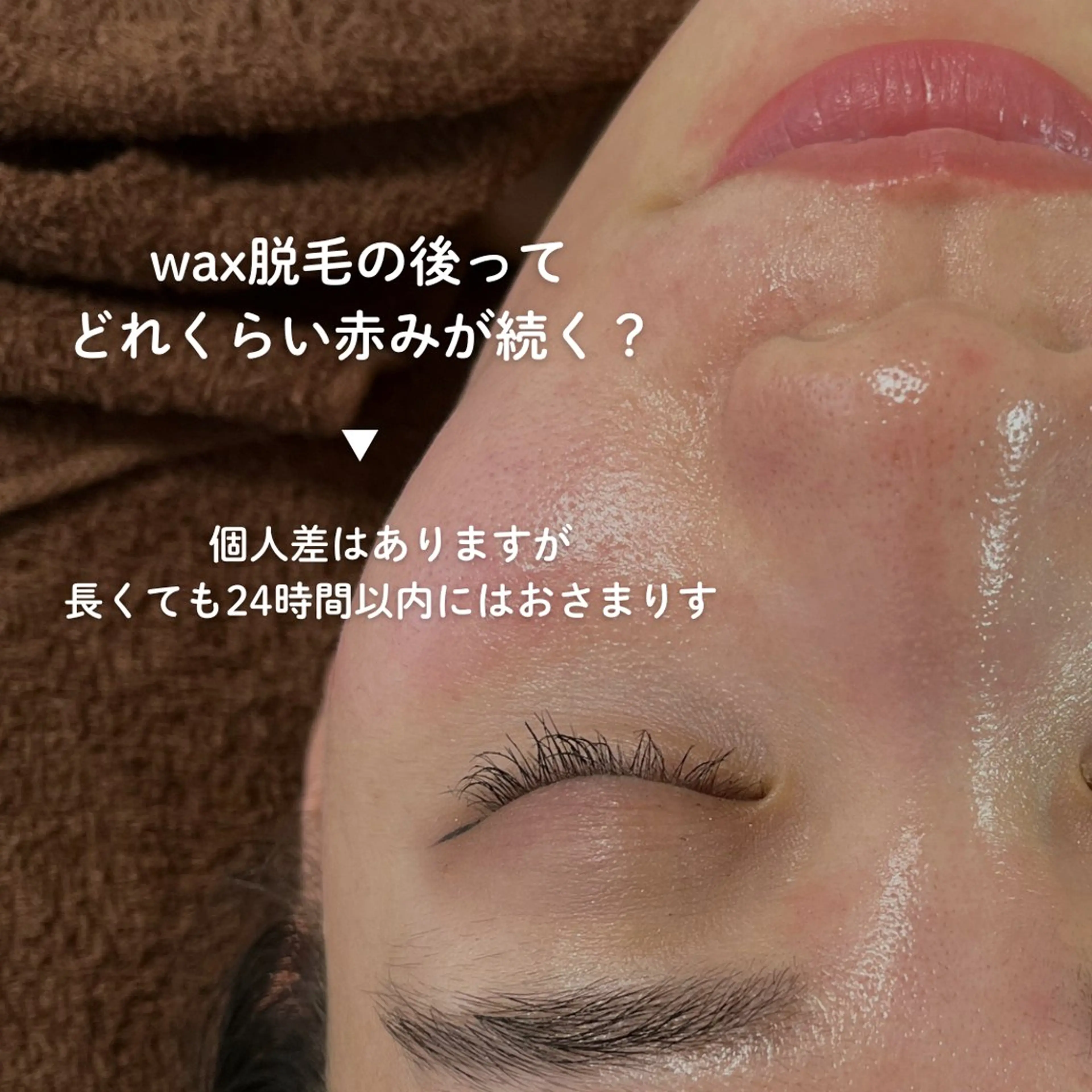 EST BEAUTY所属・顔ワックス脱毛/ ハーブピーリングのエステ・リラクイメージ