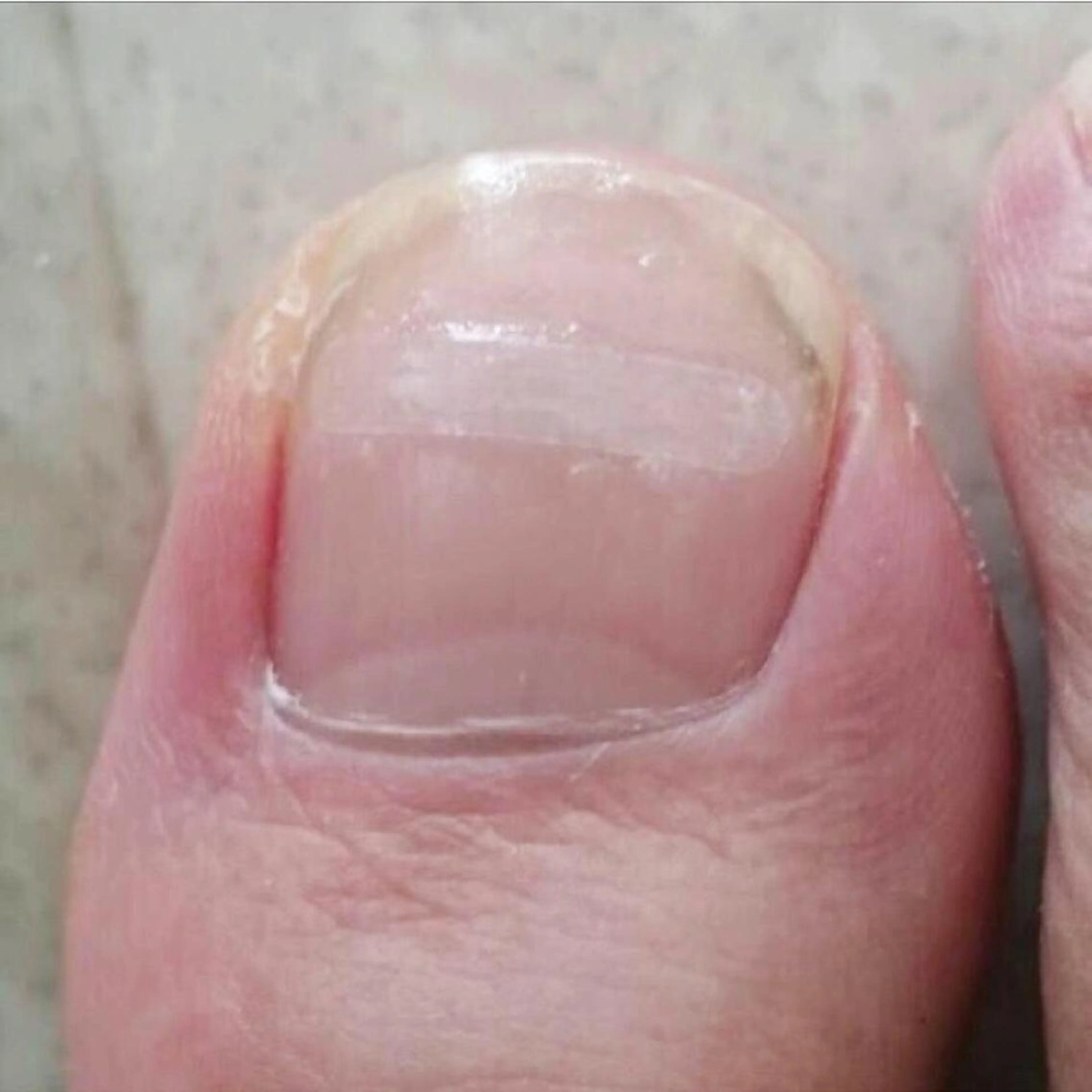 ショート カラー メンズ キッズ ネイル その他 フットケアサロンすりーぴんぐ田端店所属・🌱 ま　し　お　🌱のエステ・リラクイメージ