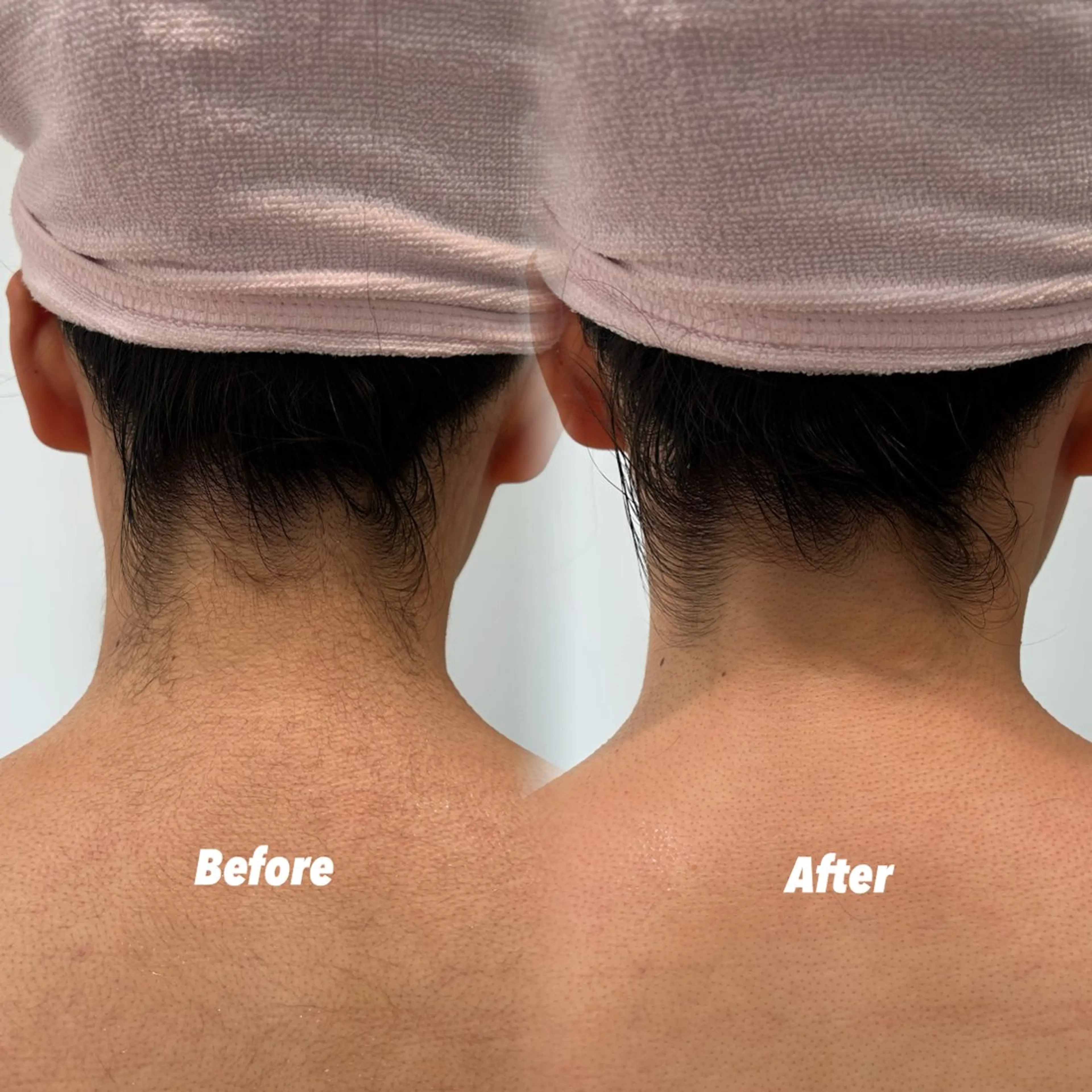 エステ リラク 🫧美しい素肌へ🫧 今成柚乃のその他イメージ