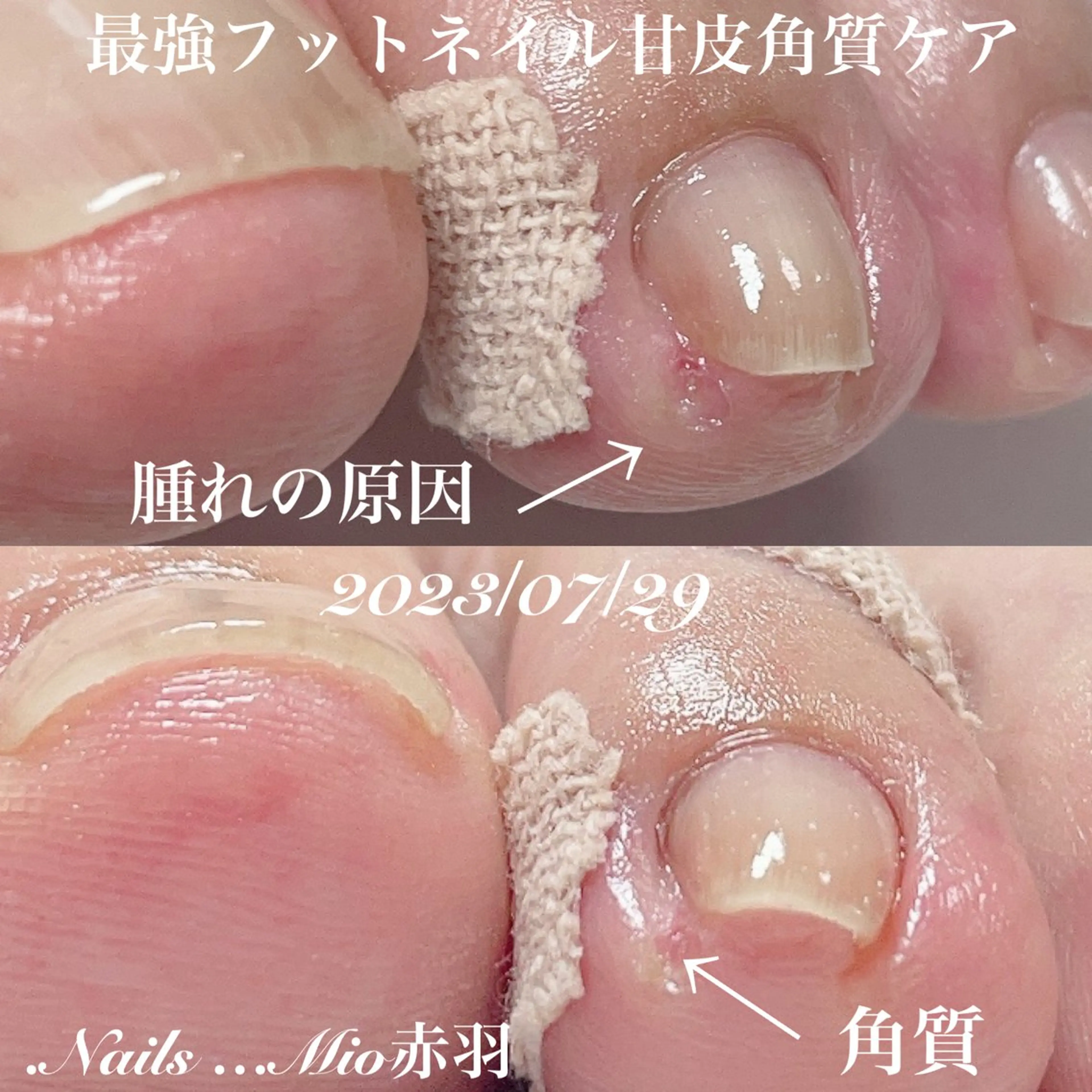 ネイル フットネイル フットネイル .Nails Mio 赤羽西ネイルサロンのネイルデザイン