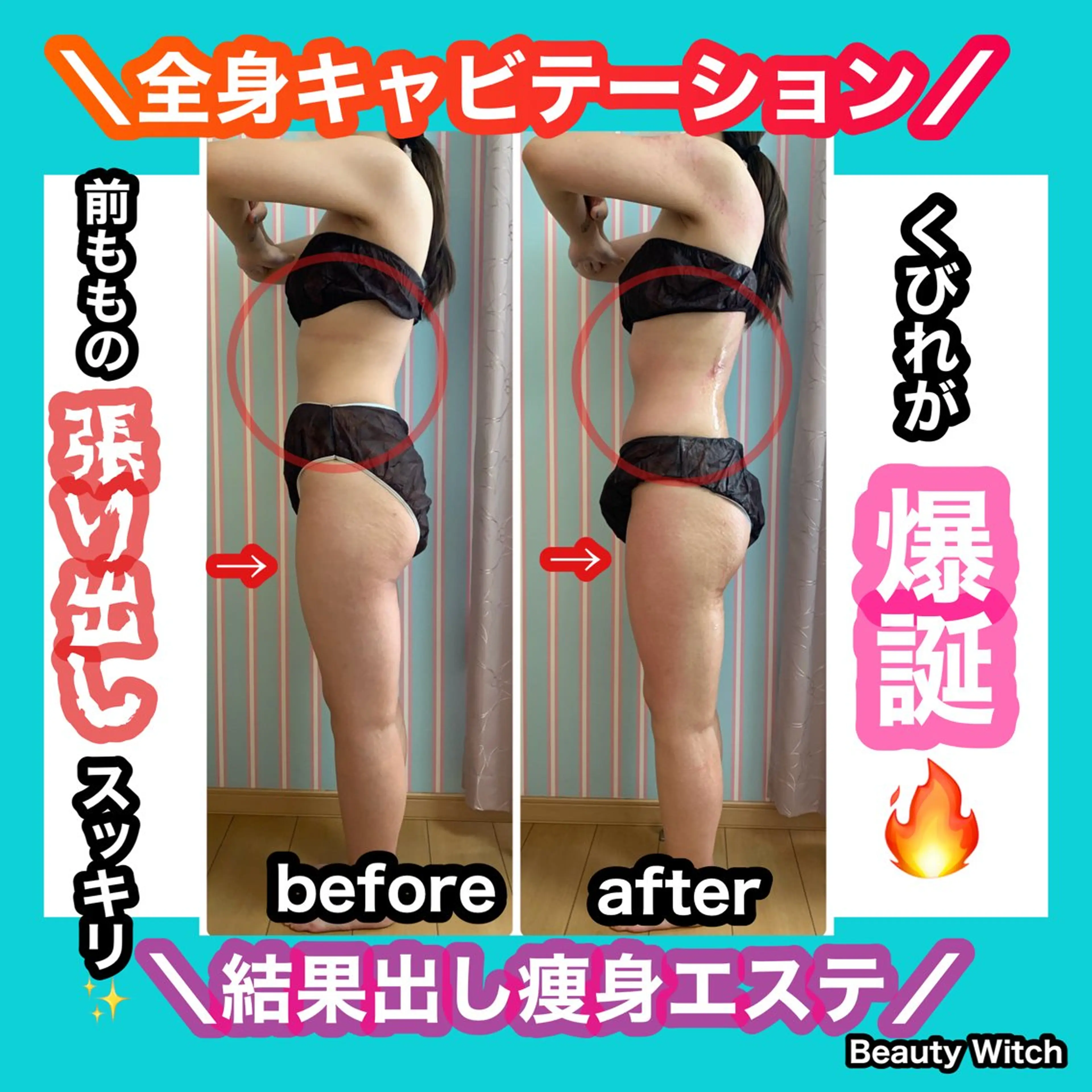 エステ リラク 痩身/脱毛/ネイル HARUKAのエステ・リラクイメージ