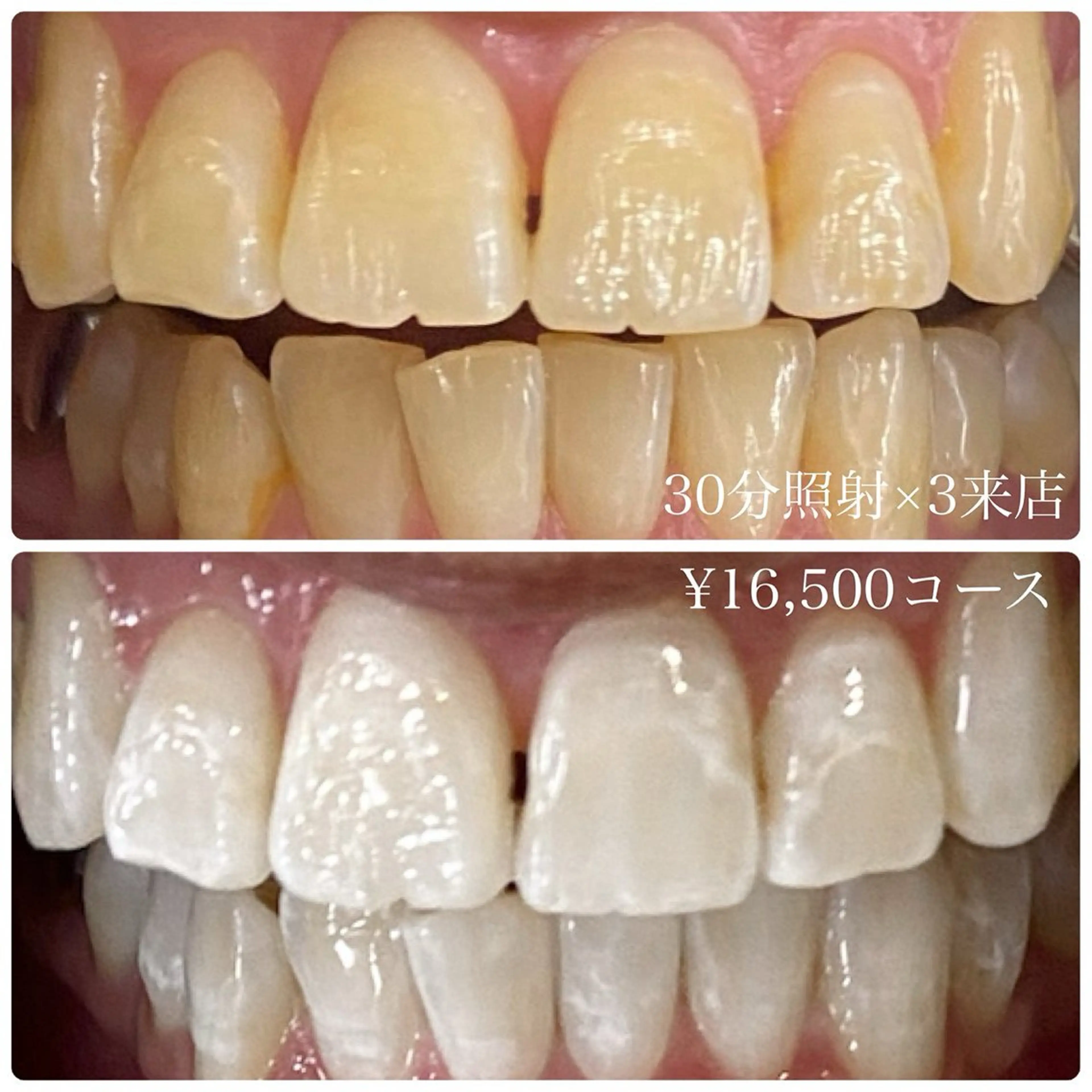 その他 PLATINUM Beauty 横浜店所属・ホワイトニングルーム 横浜店のその他イメージ