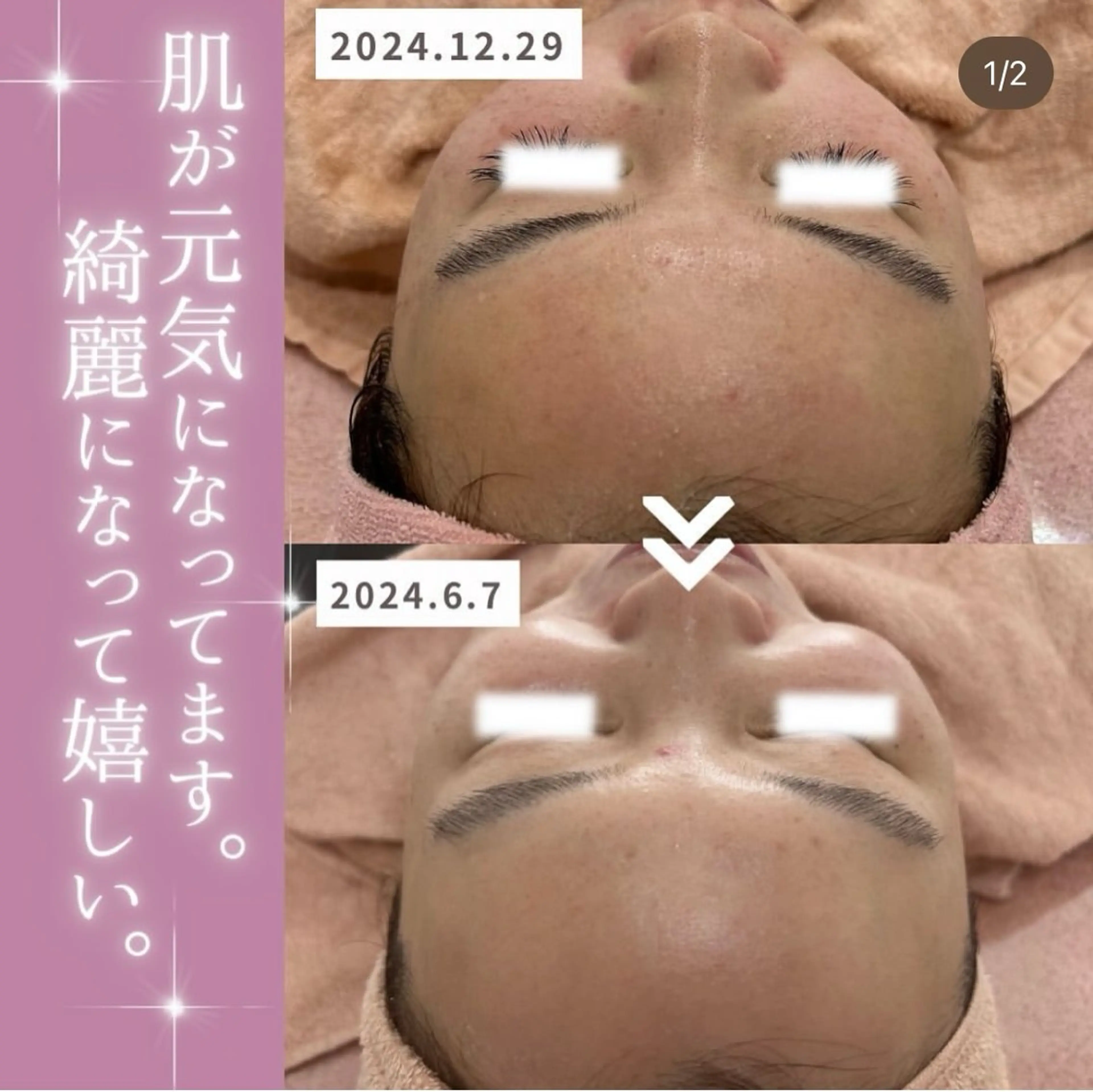 エステ 【現役看護師】高来 笑子のエステ・リラクイメージ