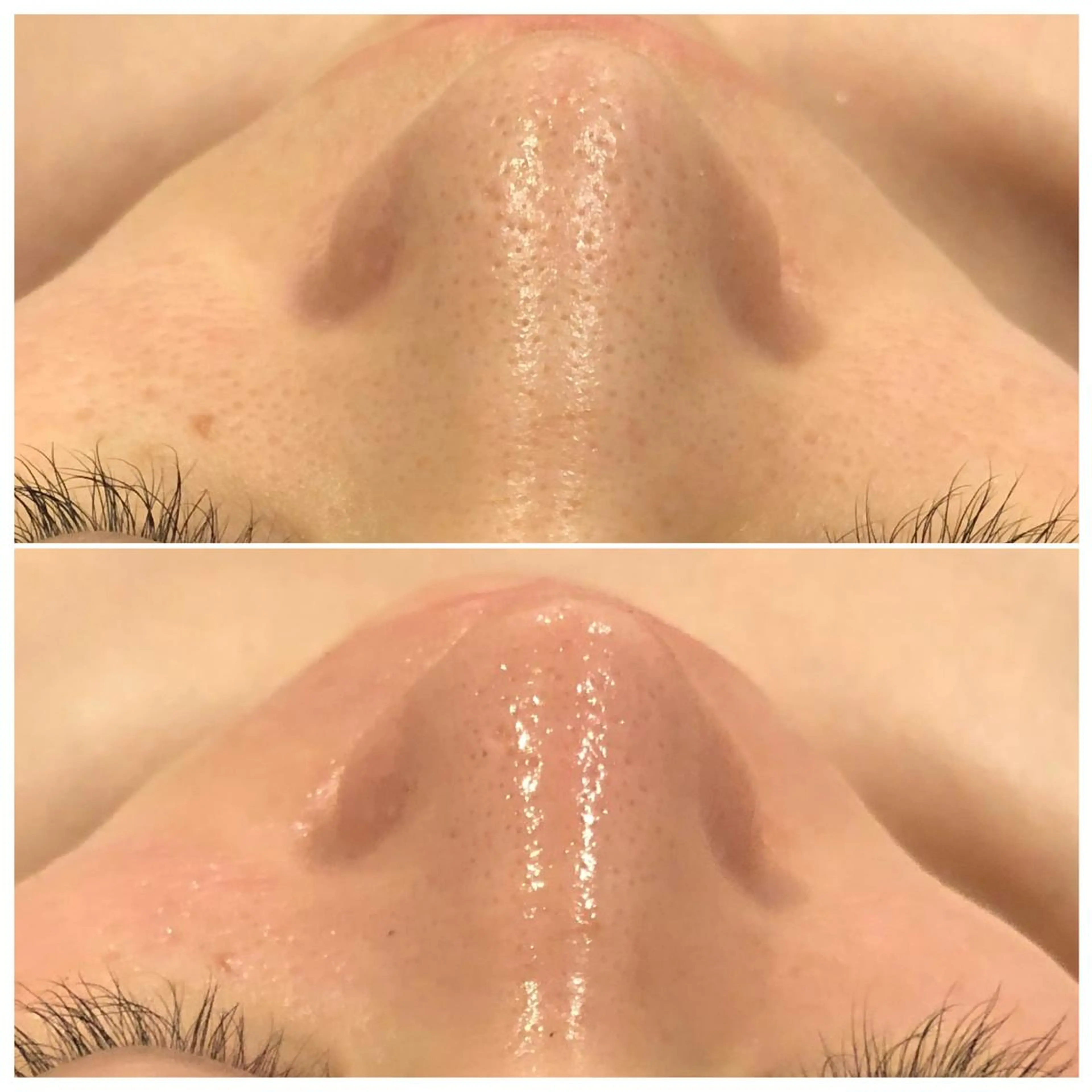 エステ リラク 通うほど変わる本格 エステ心斎橋REVIのエステ・リラクイメージ