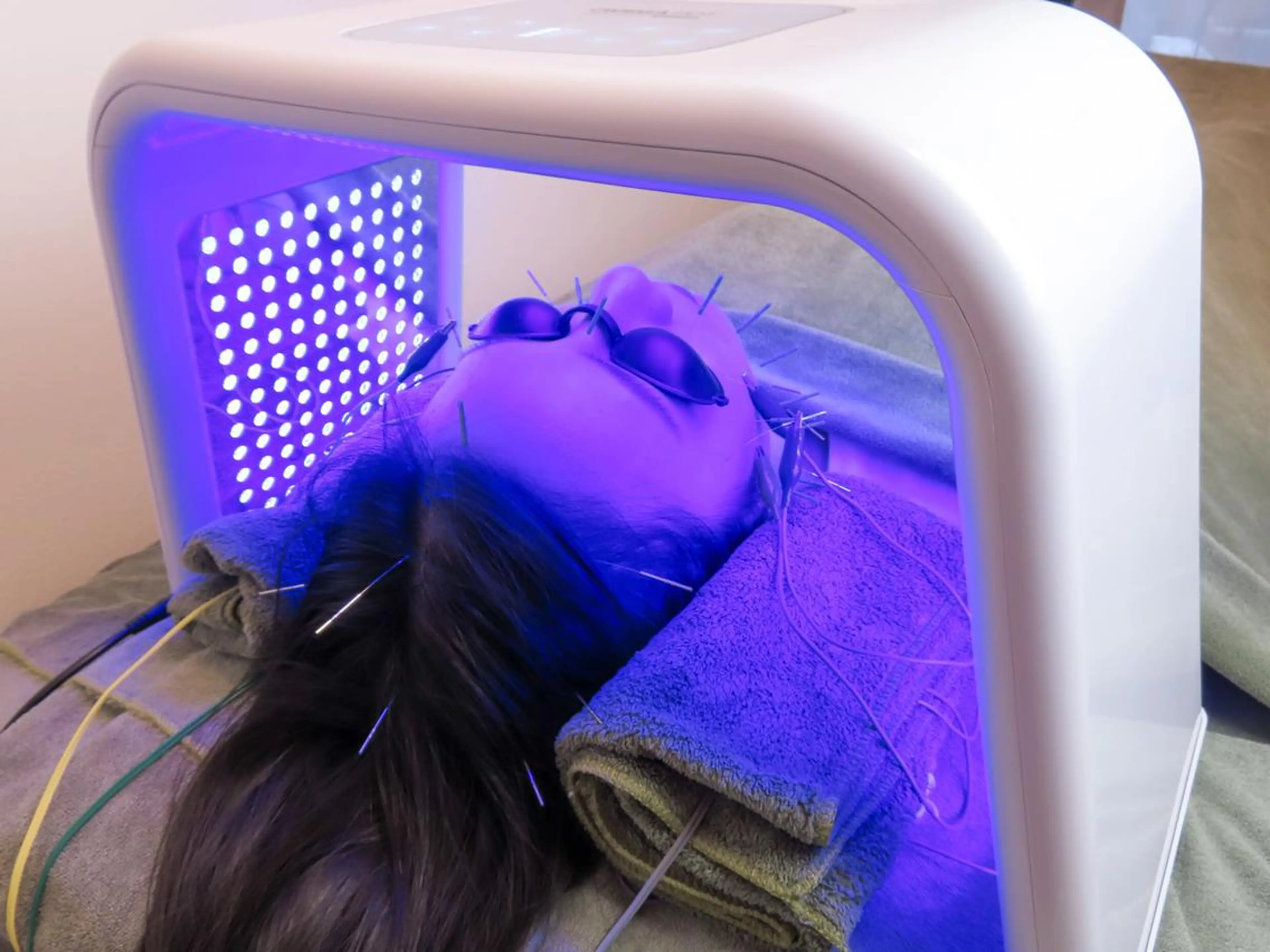 エステ リラク 美容とカラダの鍼灸 サロン やなけんのエステ・リラクイメージ