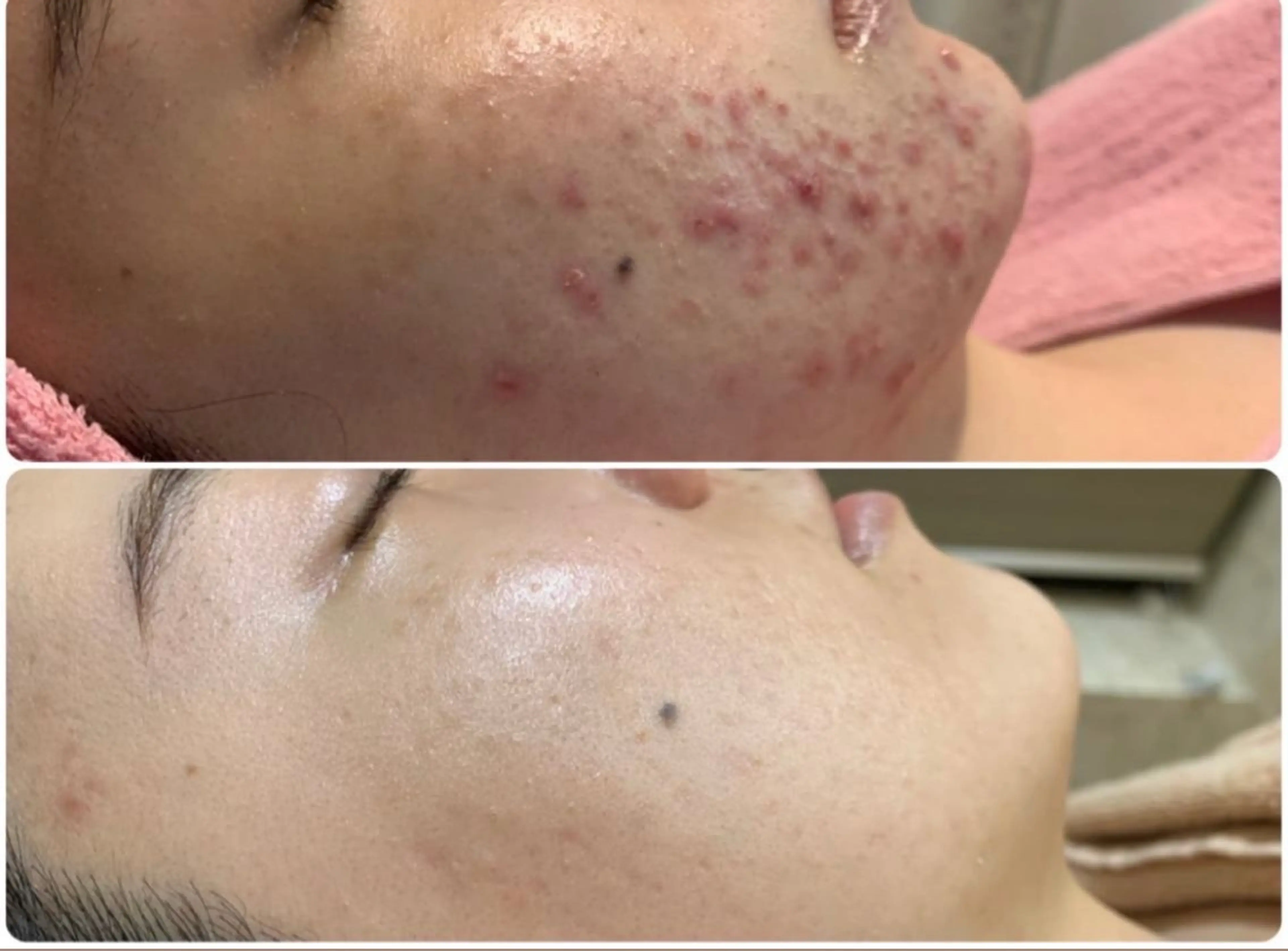 エステ矢野 ジョアアンジェ心斎橋のエステ・リラクイメージ