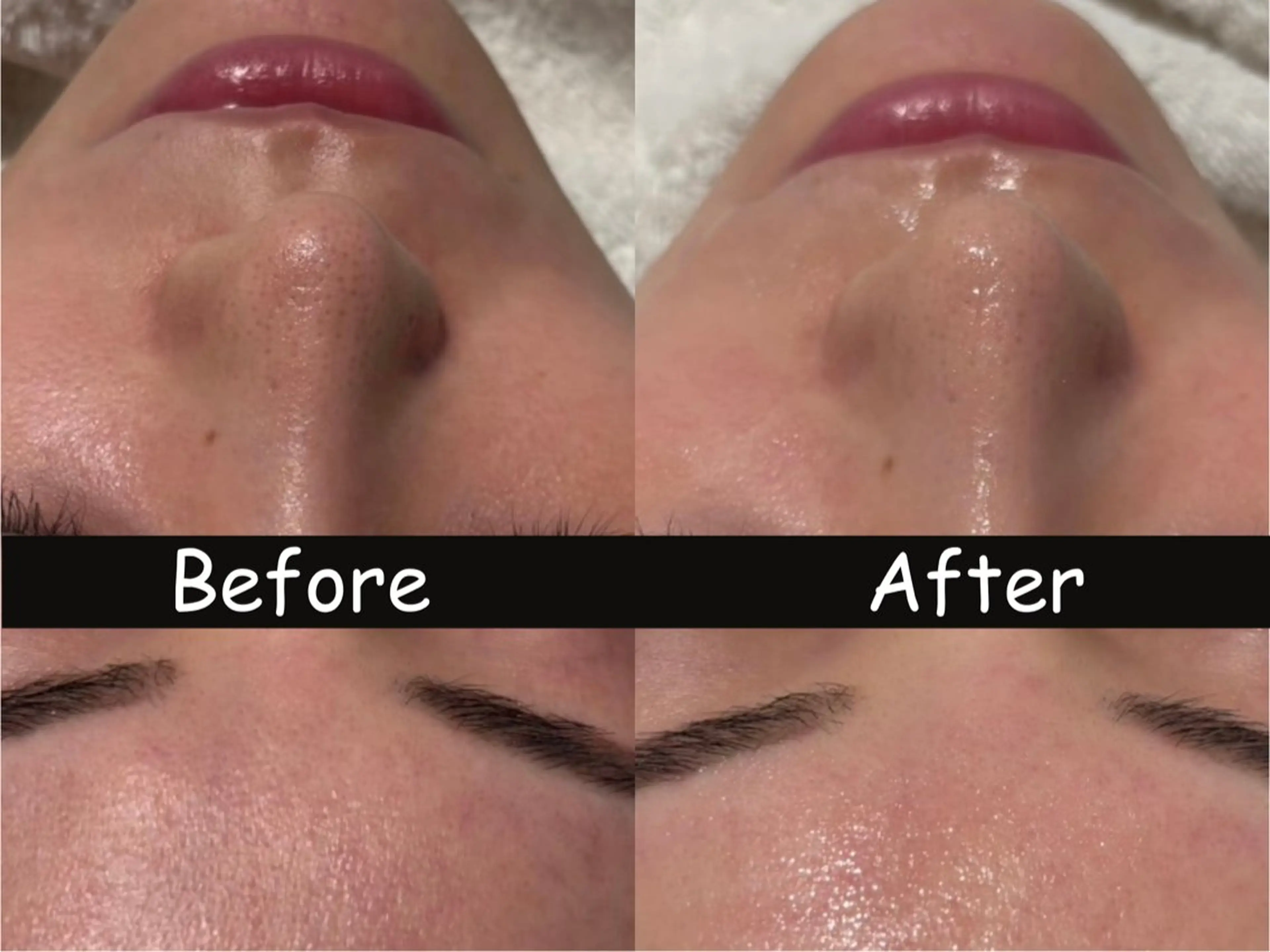 エステ 四ツ橋フェイシャル Rebornのエステ・リラクイメージ