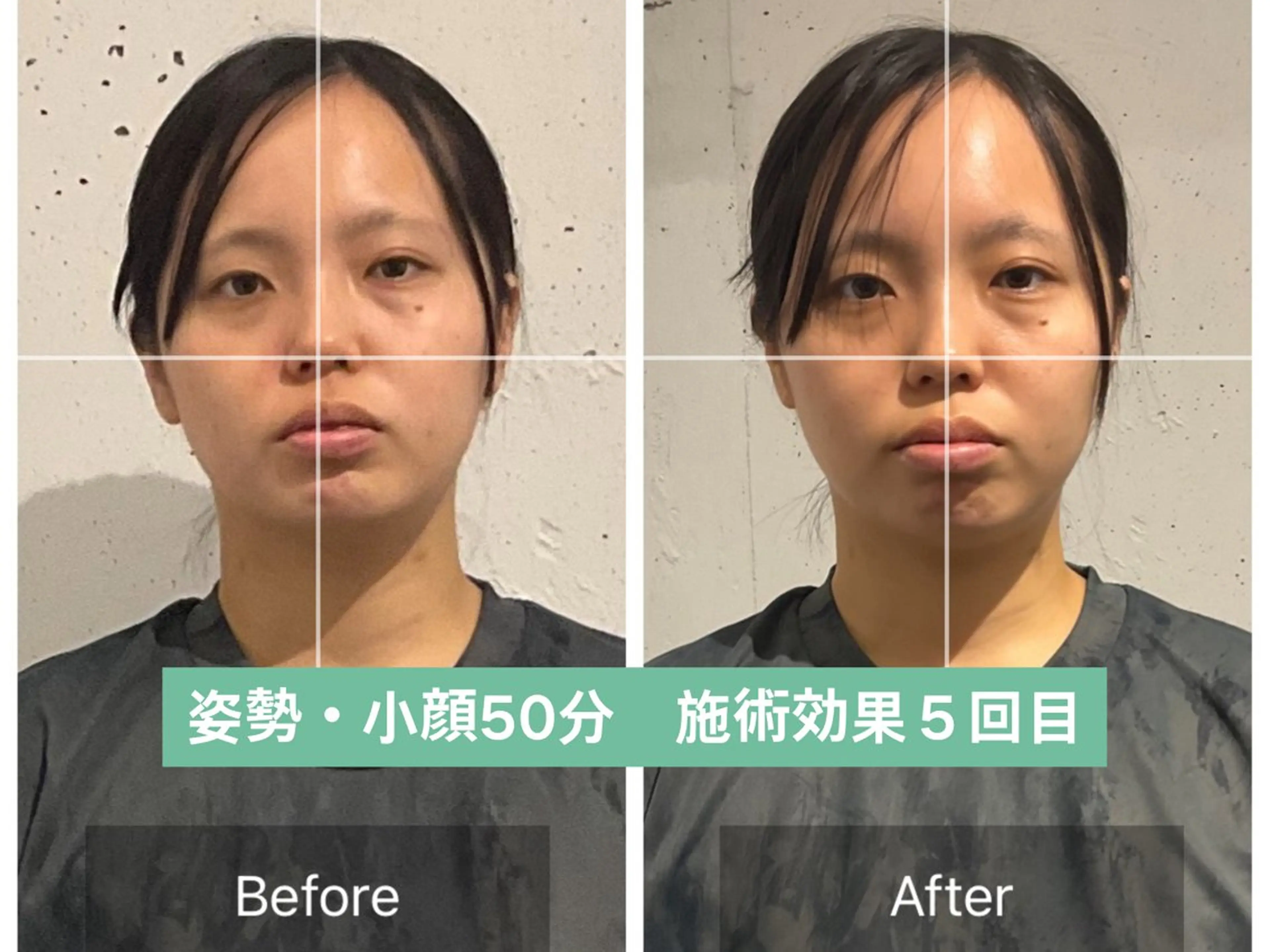 美容整体　小顔矯正 プラスフィール青田のエステ・リラクイメージ