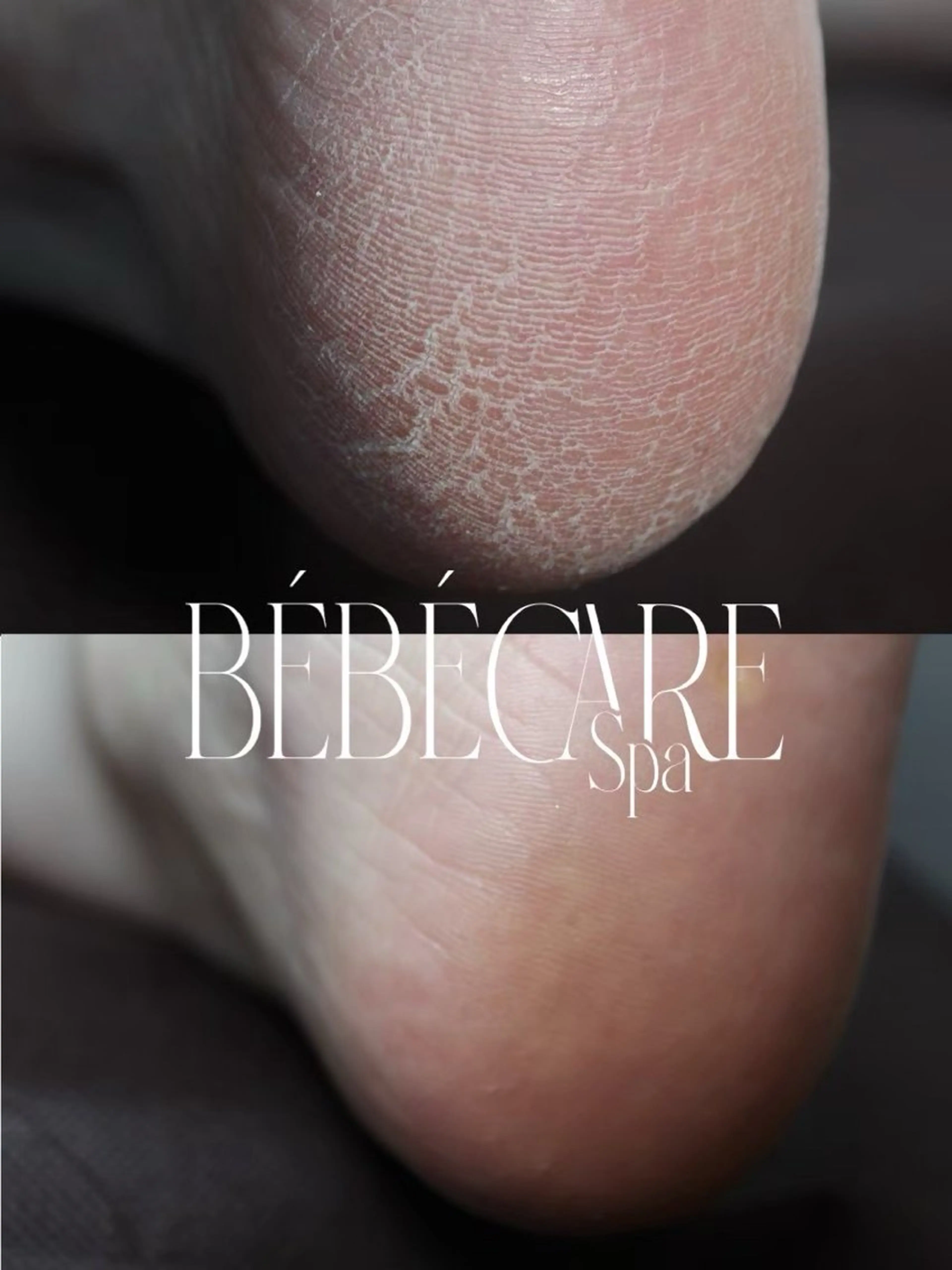 BÉBÉ CARE SPA®︎   踵の角質除去🦶before → afterちゃんと変わる、かかとケア🦶✨の写真