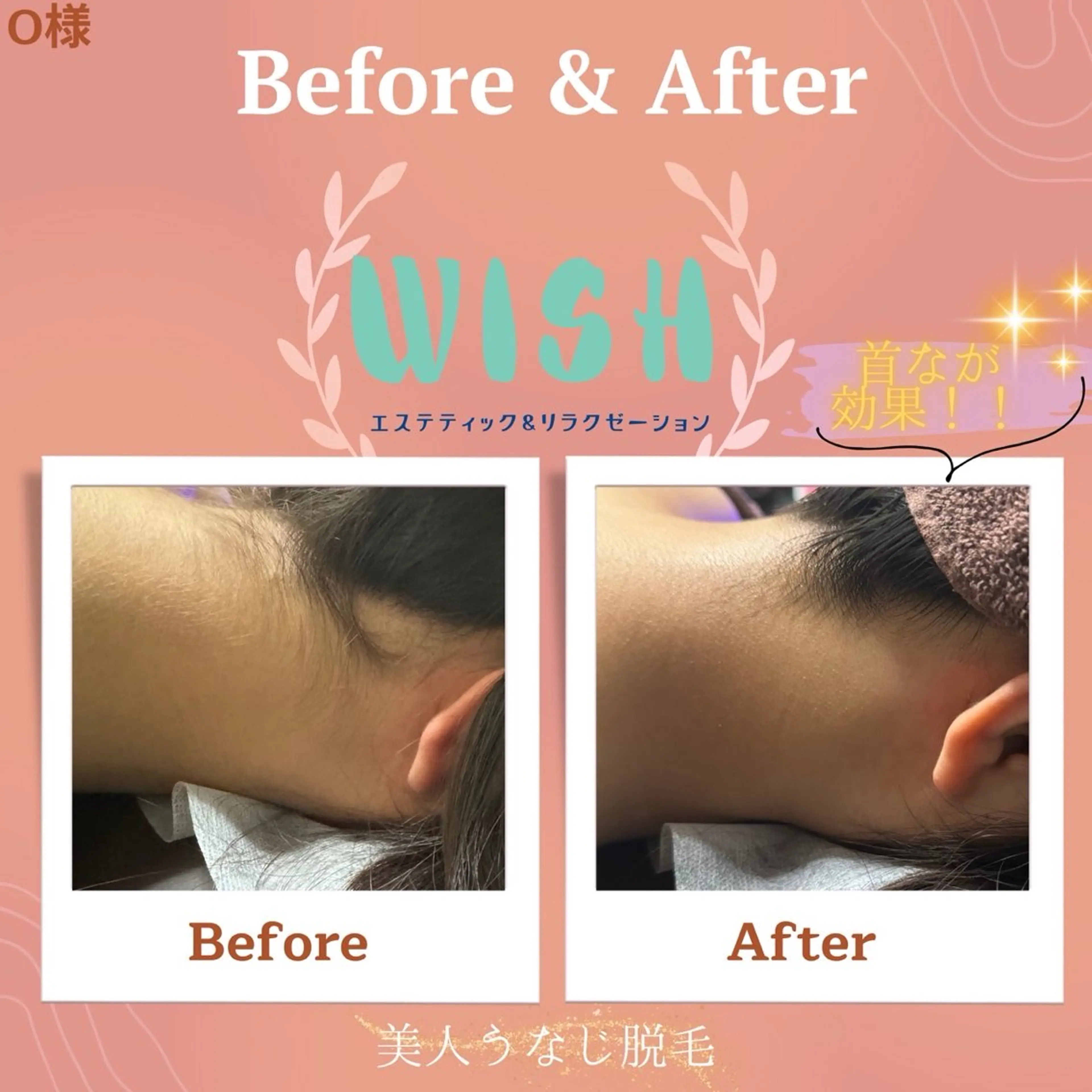 WISH 美肌脱毛のプロ！須藤のエステ・リラクイメージ