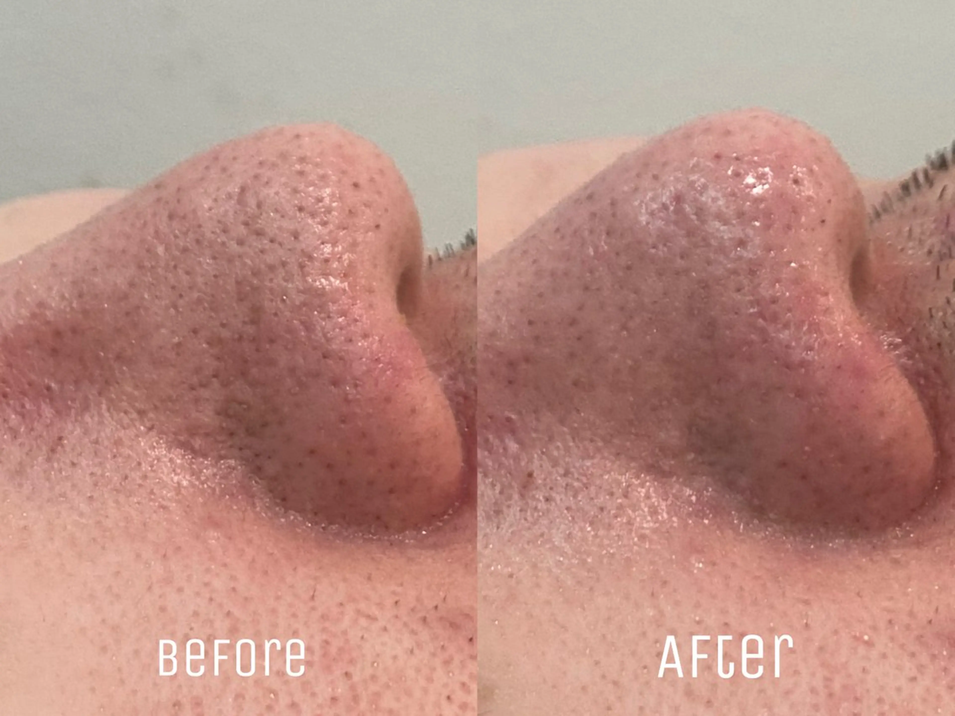 エステ ニキビ・毛穴・肌荒れ &me 西宮北口店のその他イメージ