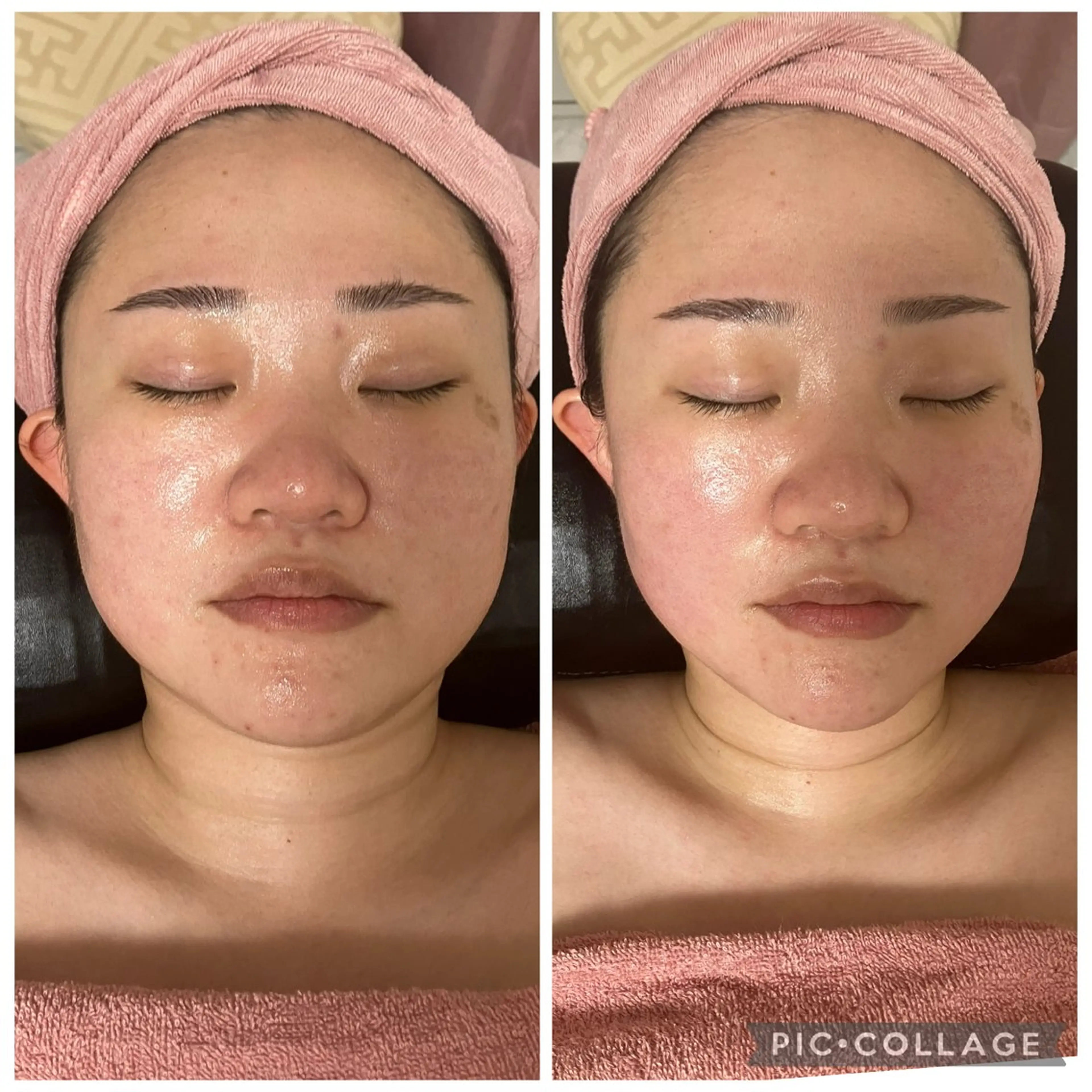 メディカルエステ　痩身·小顔専門サロンBBC 田園調布所属・KEI KOのエステ・リラクイメージ