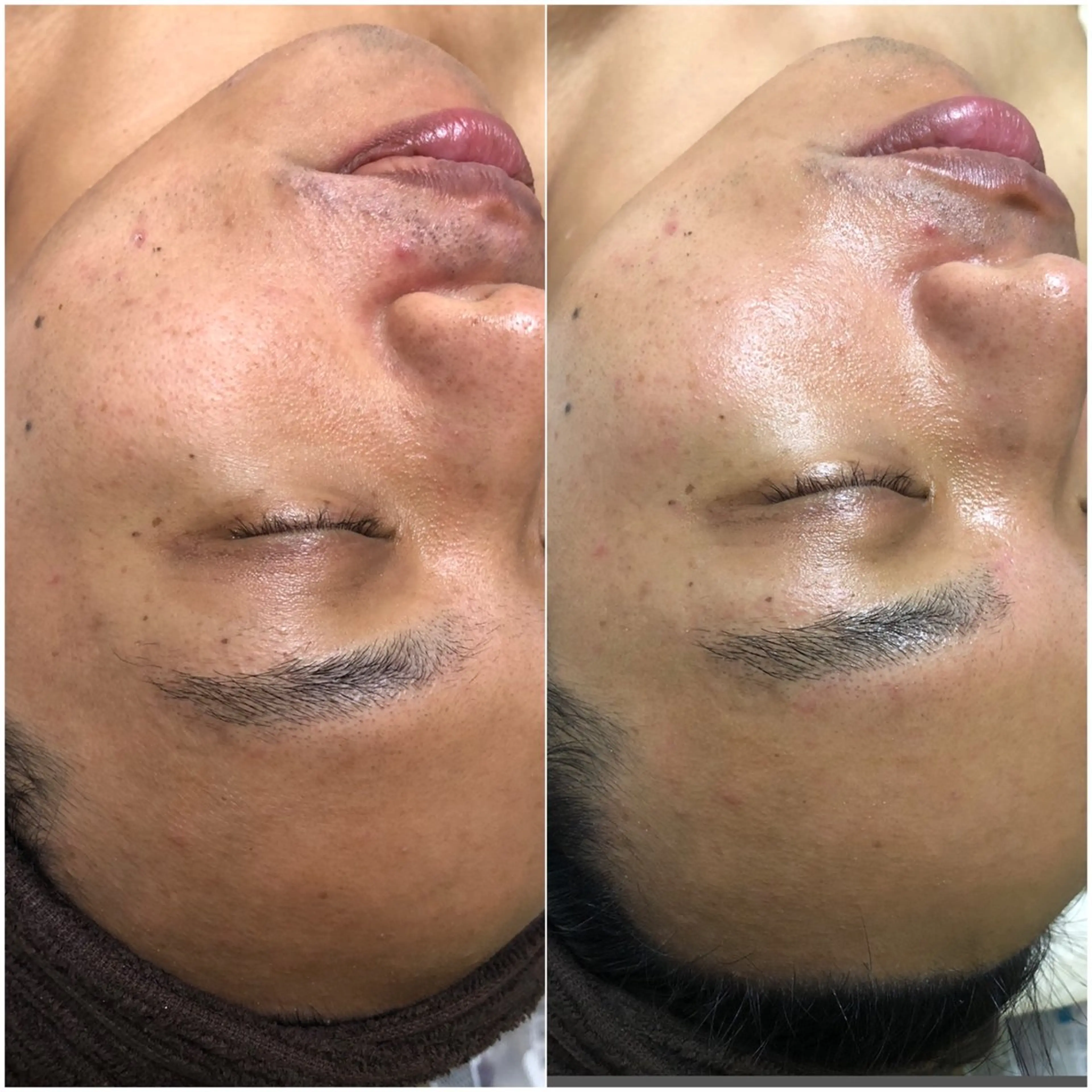 メンズ Chio-RE所属・Wax/絹肌艶肌🌼 坂結加のエステ・リラクイメージ