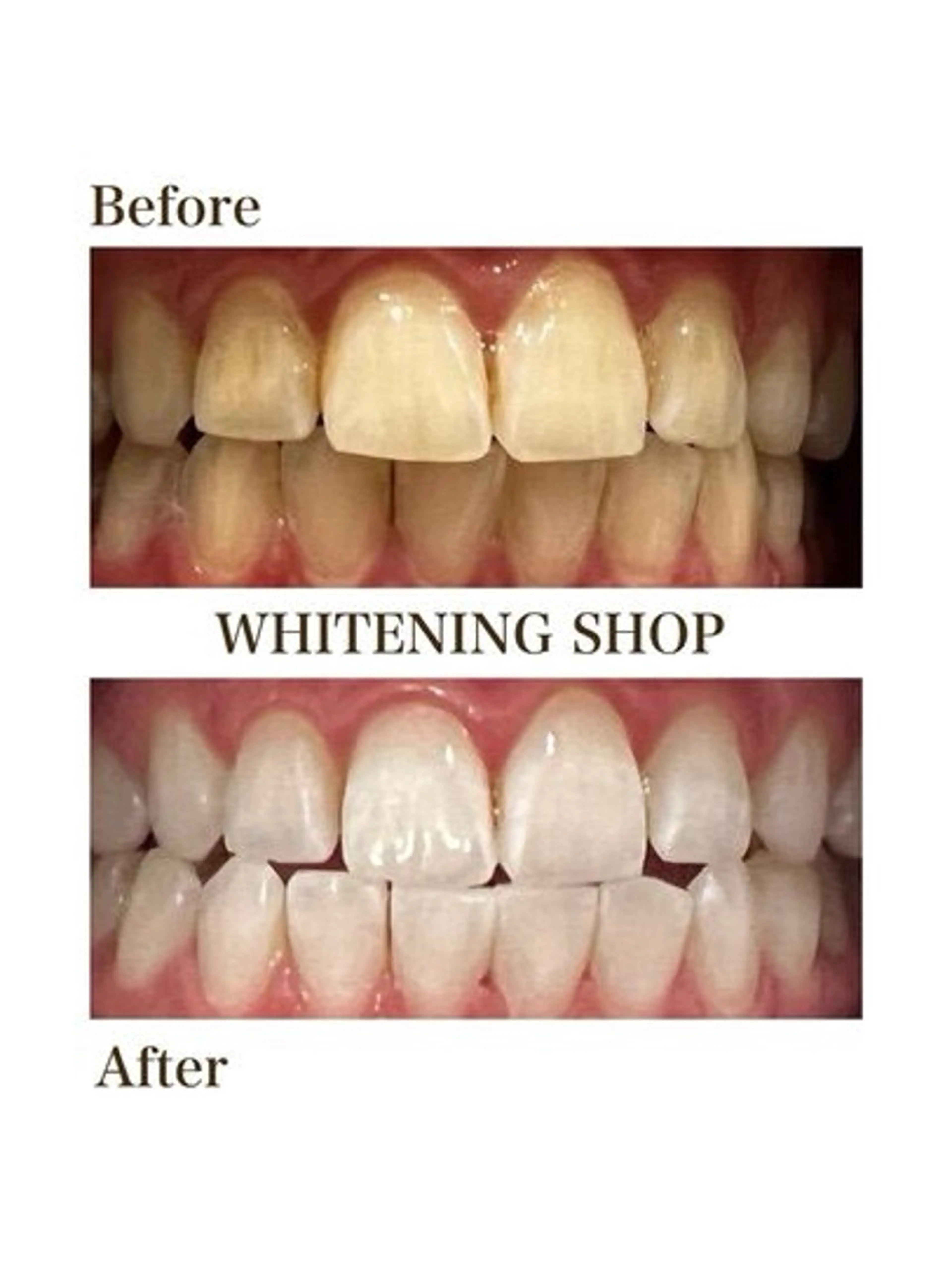 その他 ホワイトニングショップ津店所属・ホワイトニング ショップ津店のその他イメージ