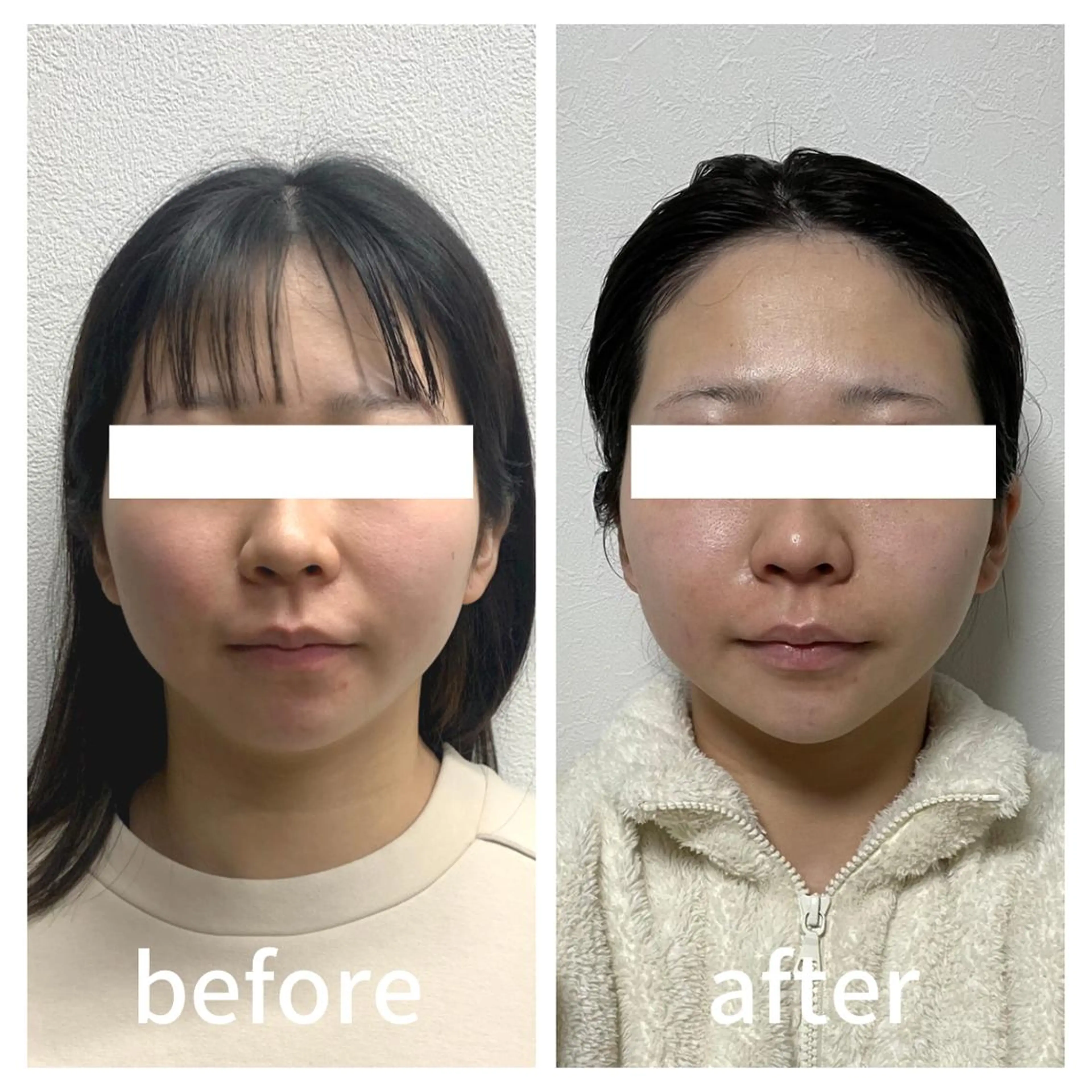 小顔サロン AMYONのエステ・リラクイメージ