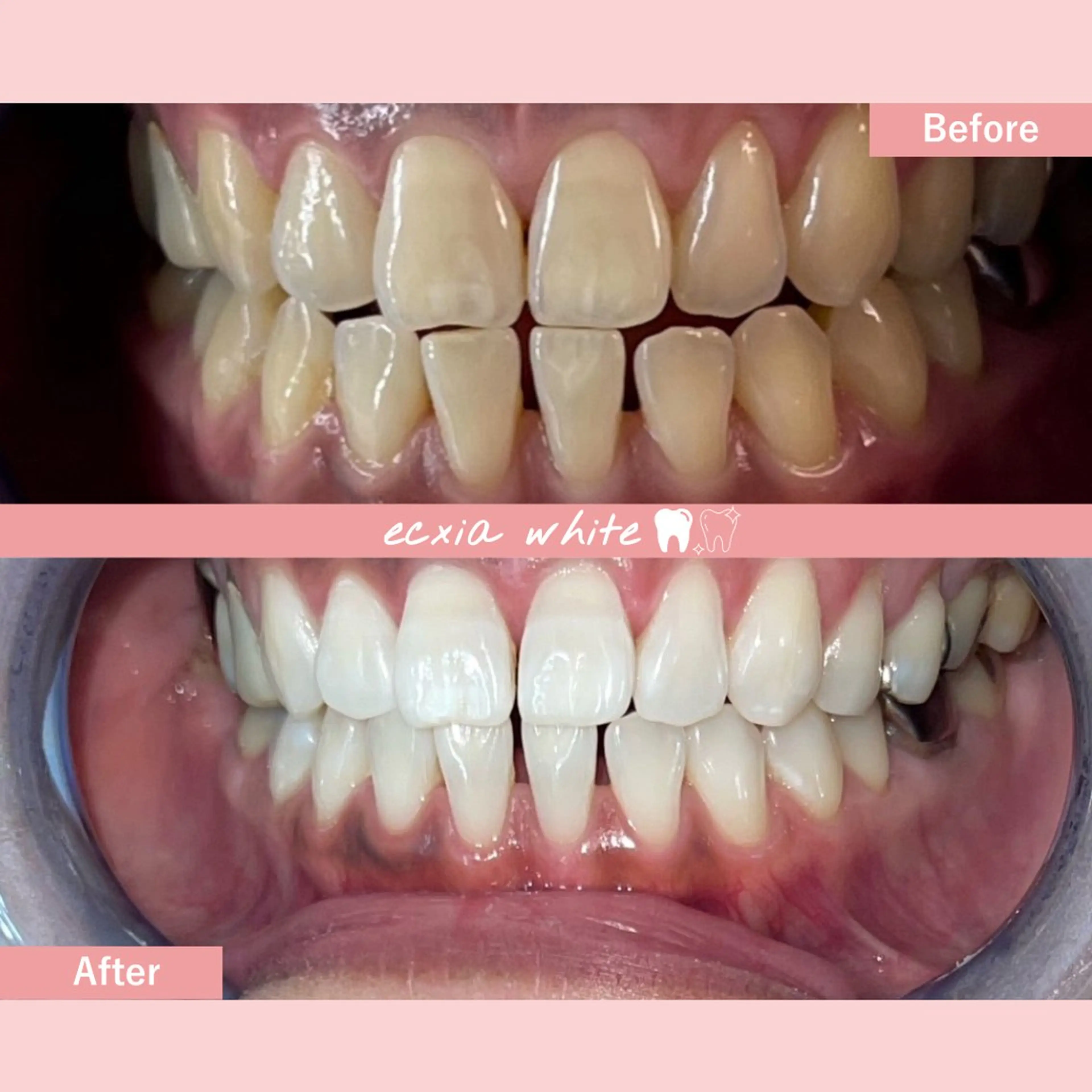 セルフホワイトニング エクシア札幌琴似店のその他イメージ