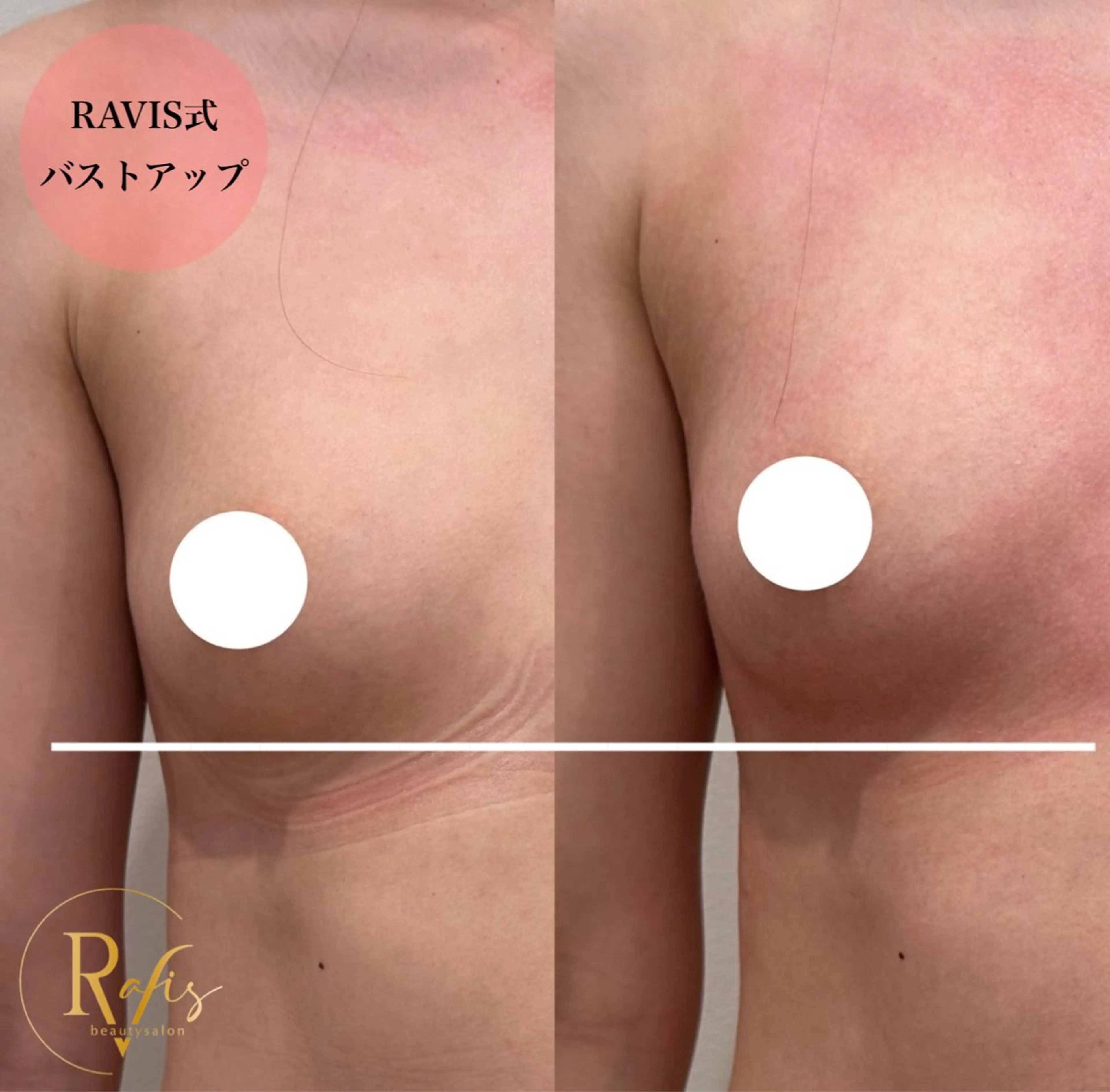 エステ beautysalon RAVIS所属・東大阪/韓国肌管理/ 痩身バスト専門店のエステ・リラクイメージ