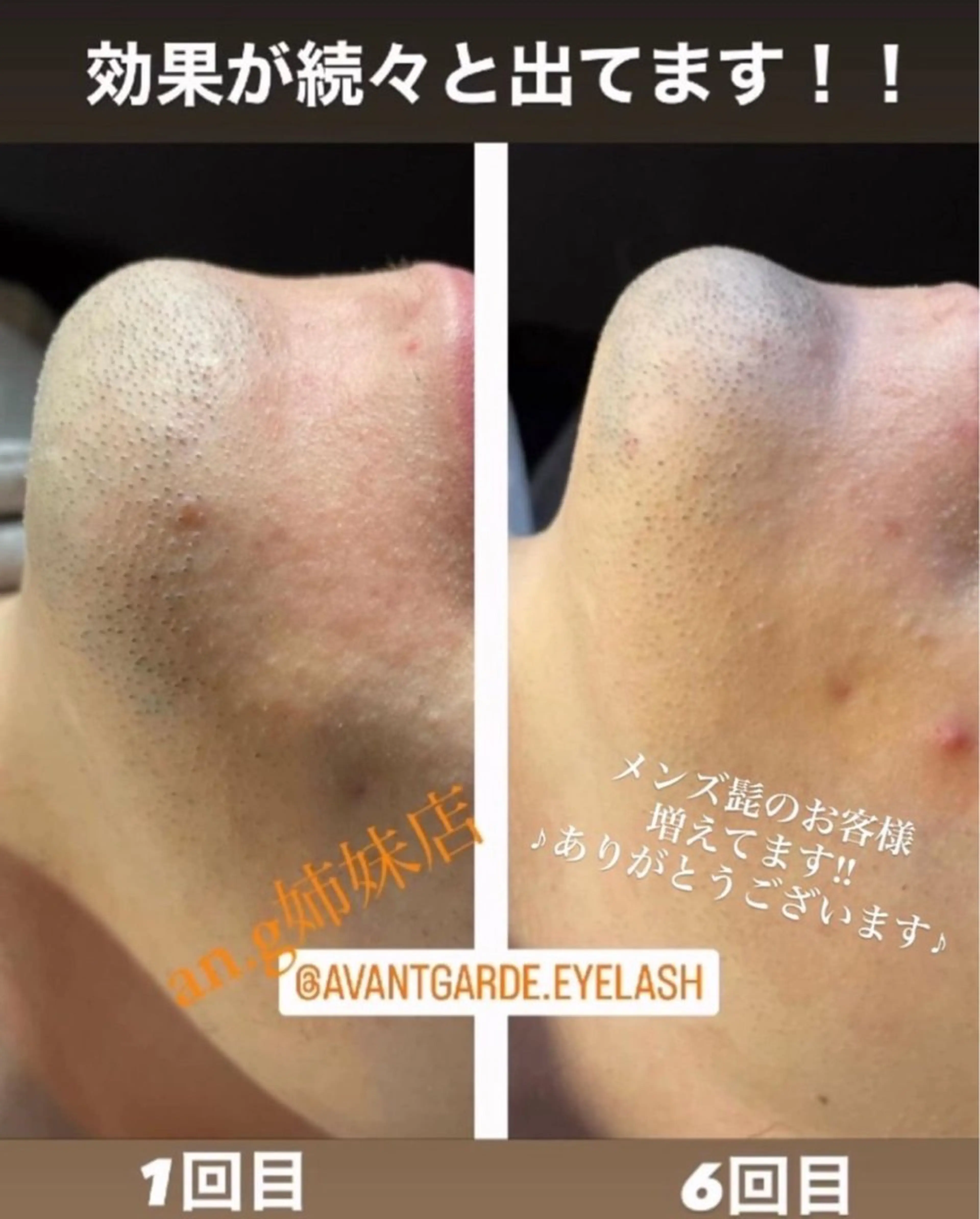 メンズ 【an.g（アン.ジー）】脱毛/フェイシャル/痩身所属・フェイシャル/脱毛 an.gアン.ジーのエステ・リラクイメージ