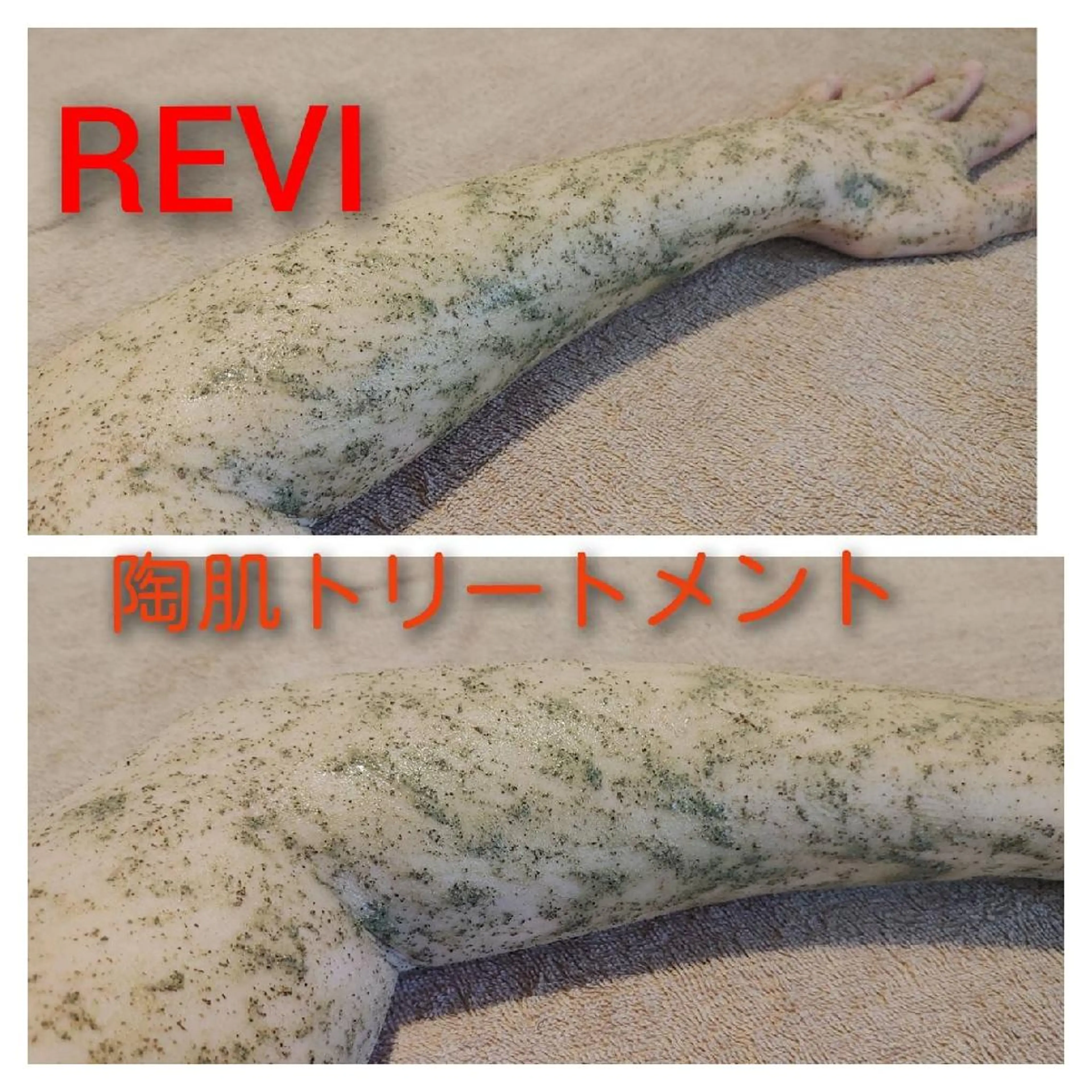 エステ viage所属・viage 脱毛&フェイシャル店のエステ・リラクイメージ