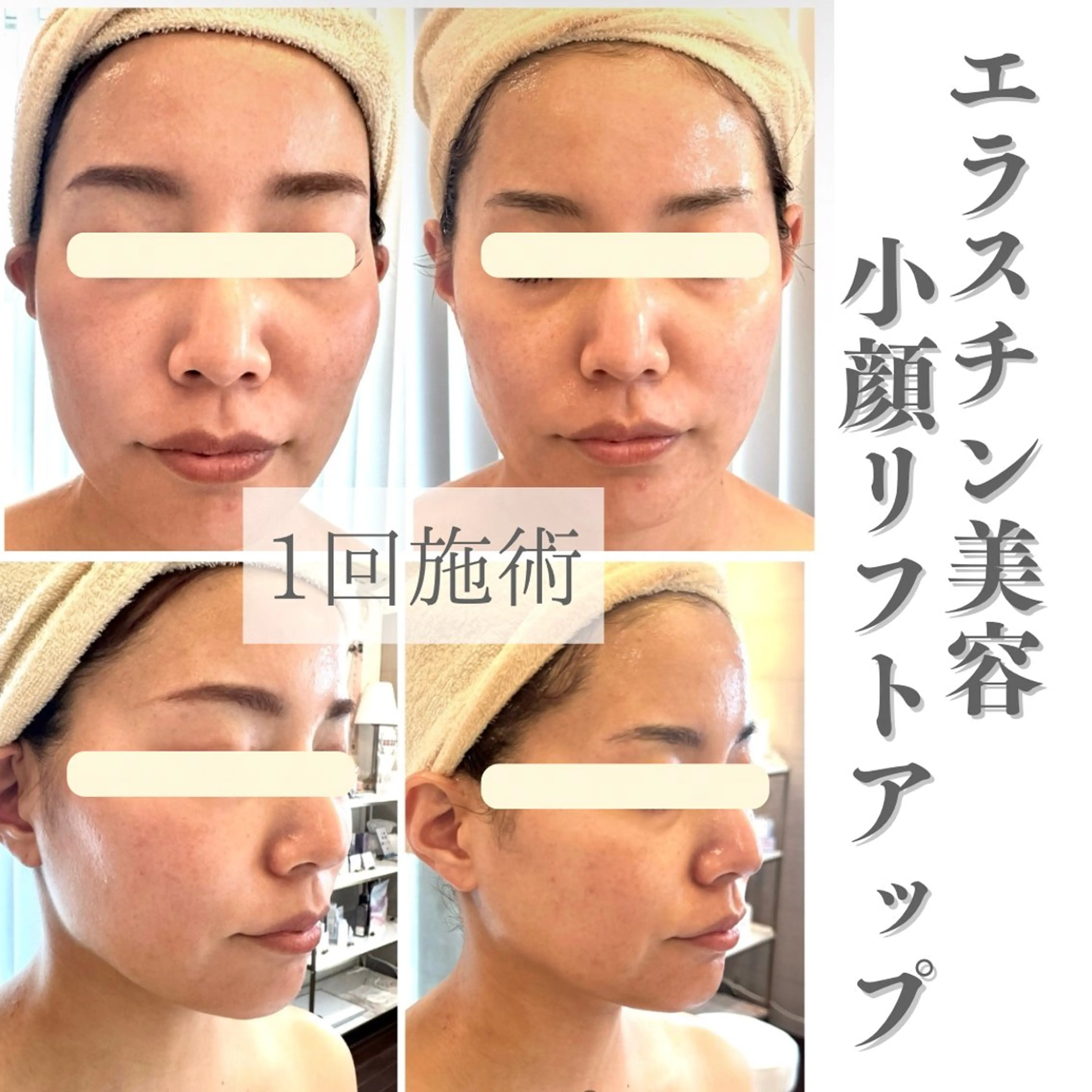 エステ beauty SalonRcoinのマツエク・マツパデザイン