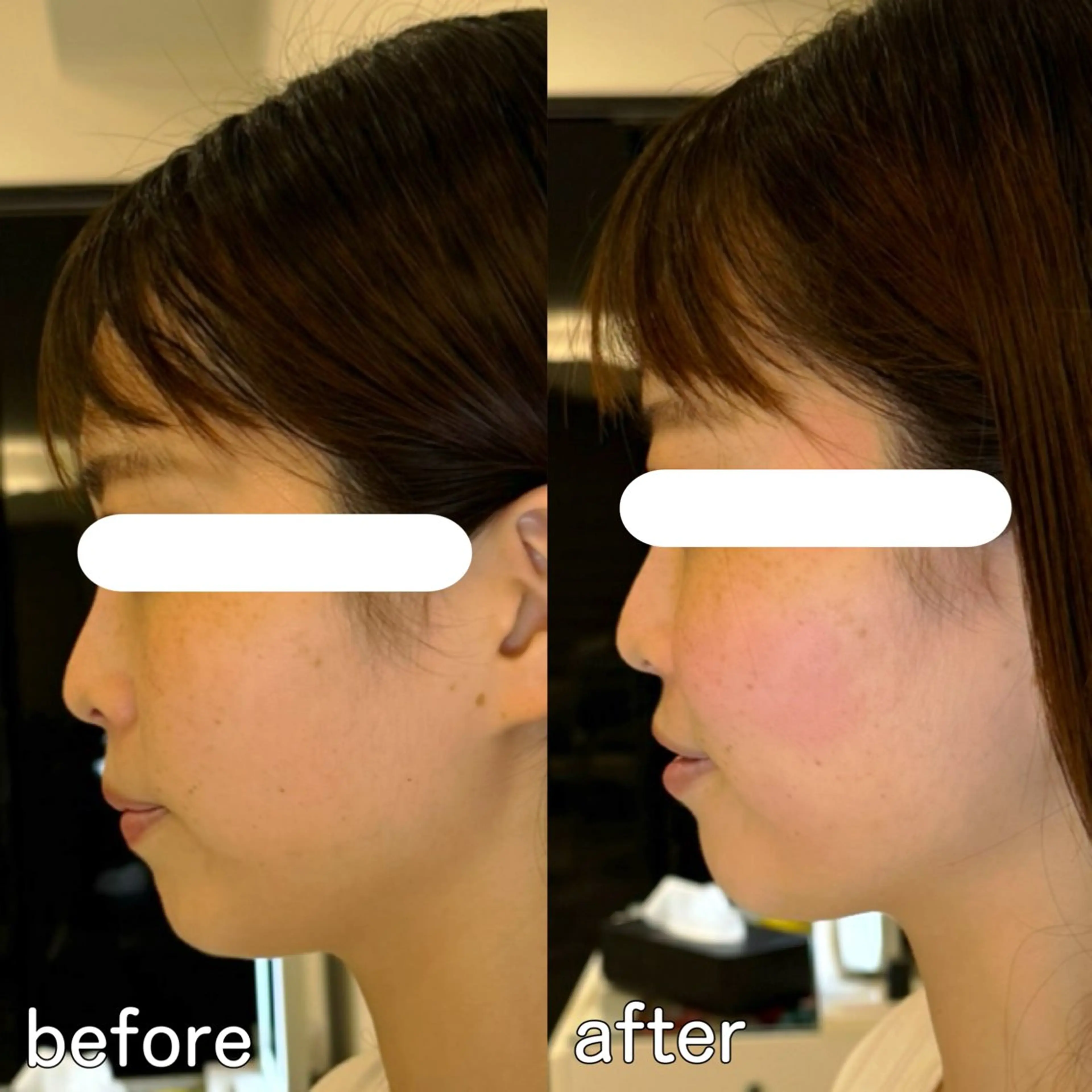 小顔矯正&美容整体 整え屋REDオーナーのエステ・リラクイメージ