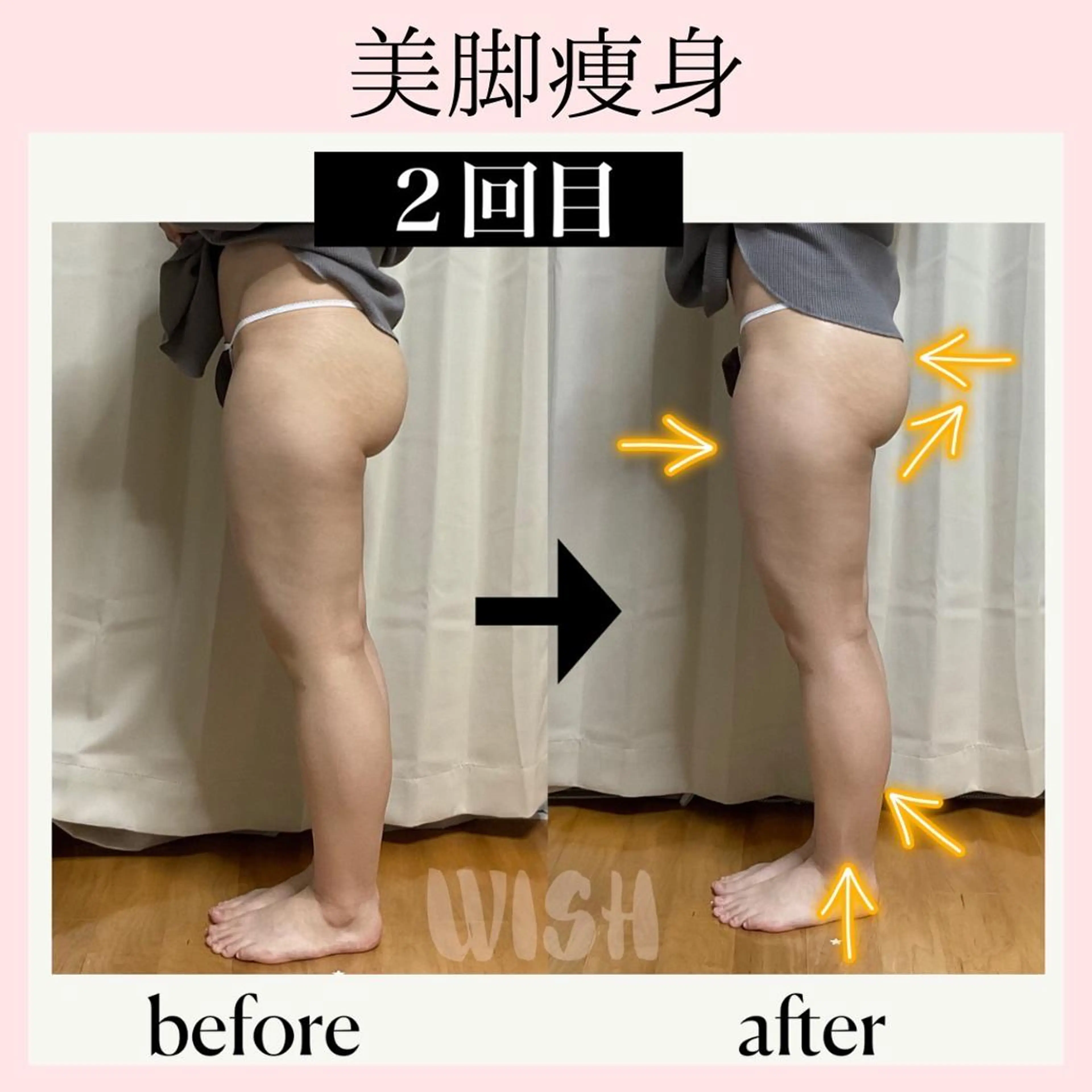 WISH 美肌脱毛のプロ！須藤のエステ・リラクイメージ