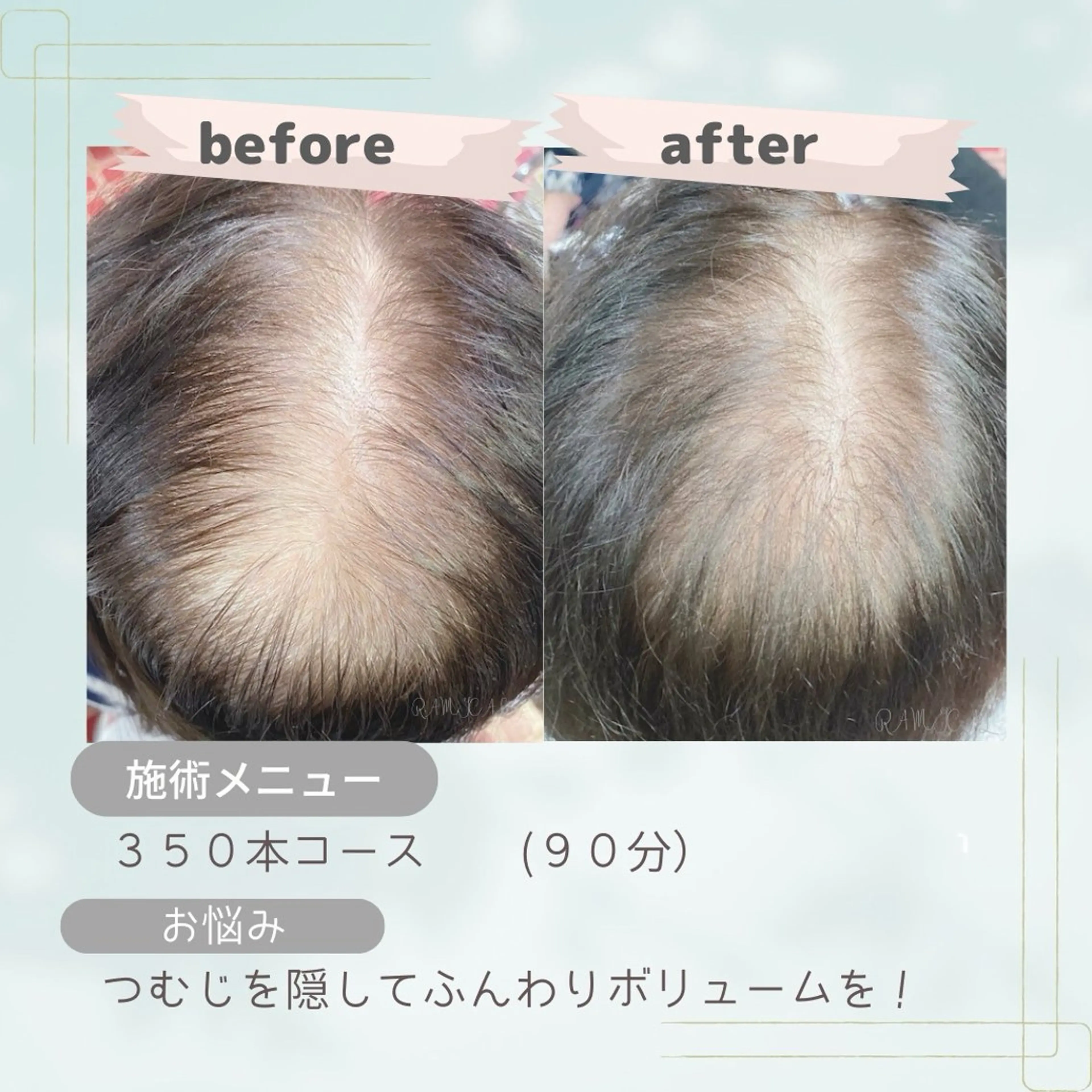 【全員OK】とことん密度UP✨800本 通常¥35,200の写真