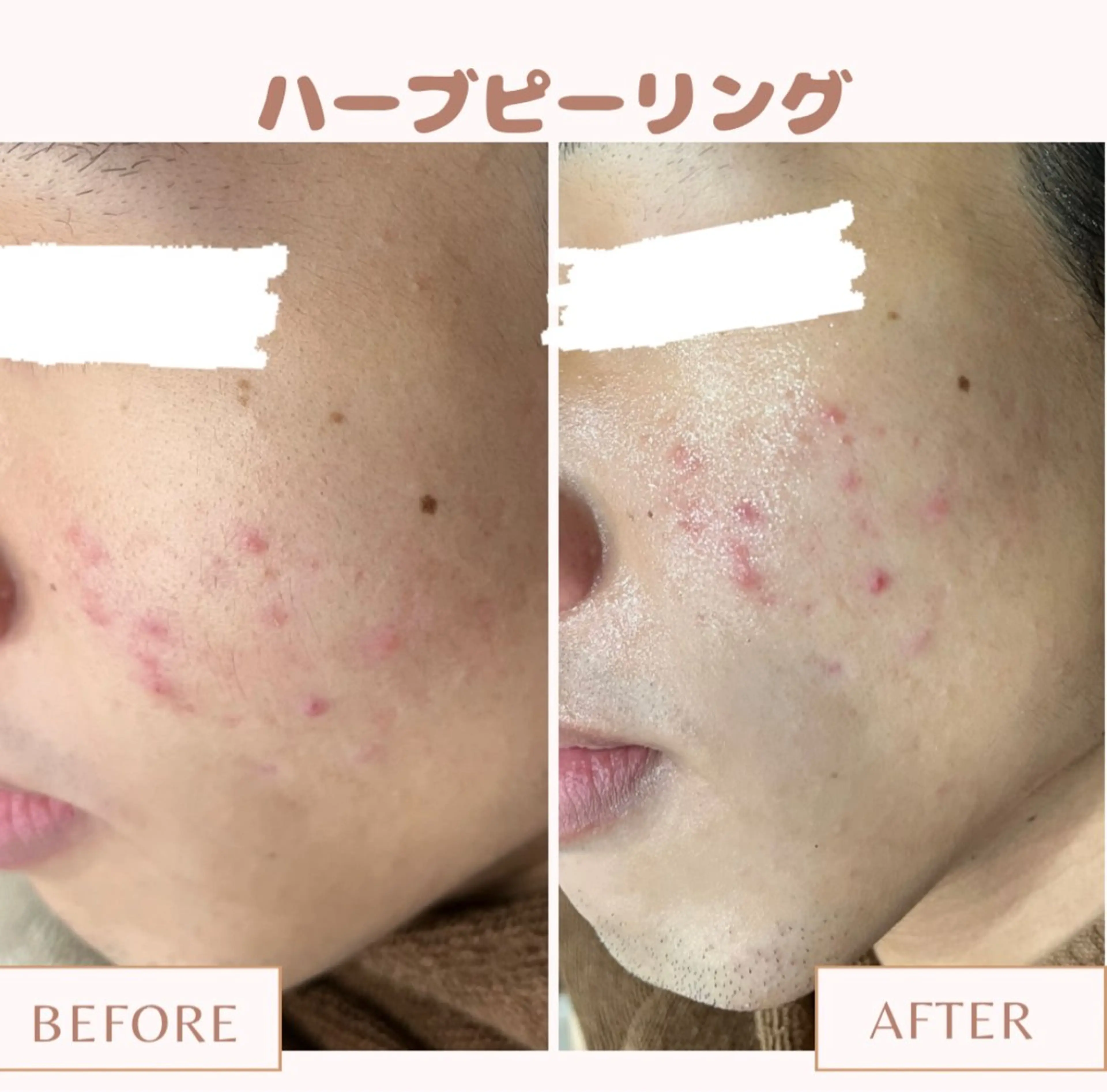 メンズ キッズ Amaryllis 💜河田のエステ・リラクイメージ