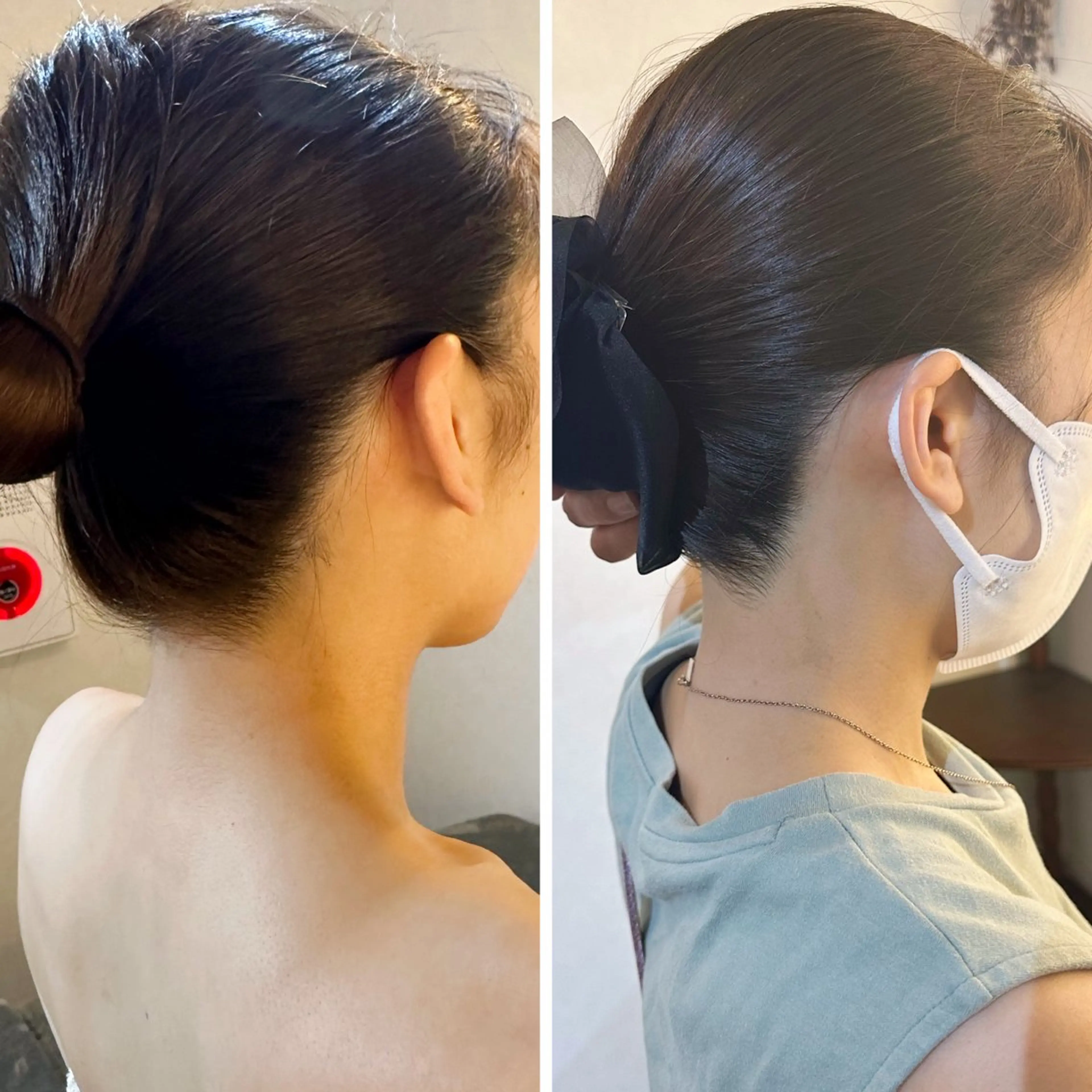 脱毛 うなじ脱毛/美肌脱毛 LABELのエステ・リラクイメージ