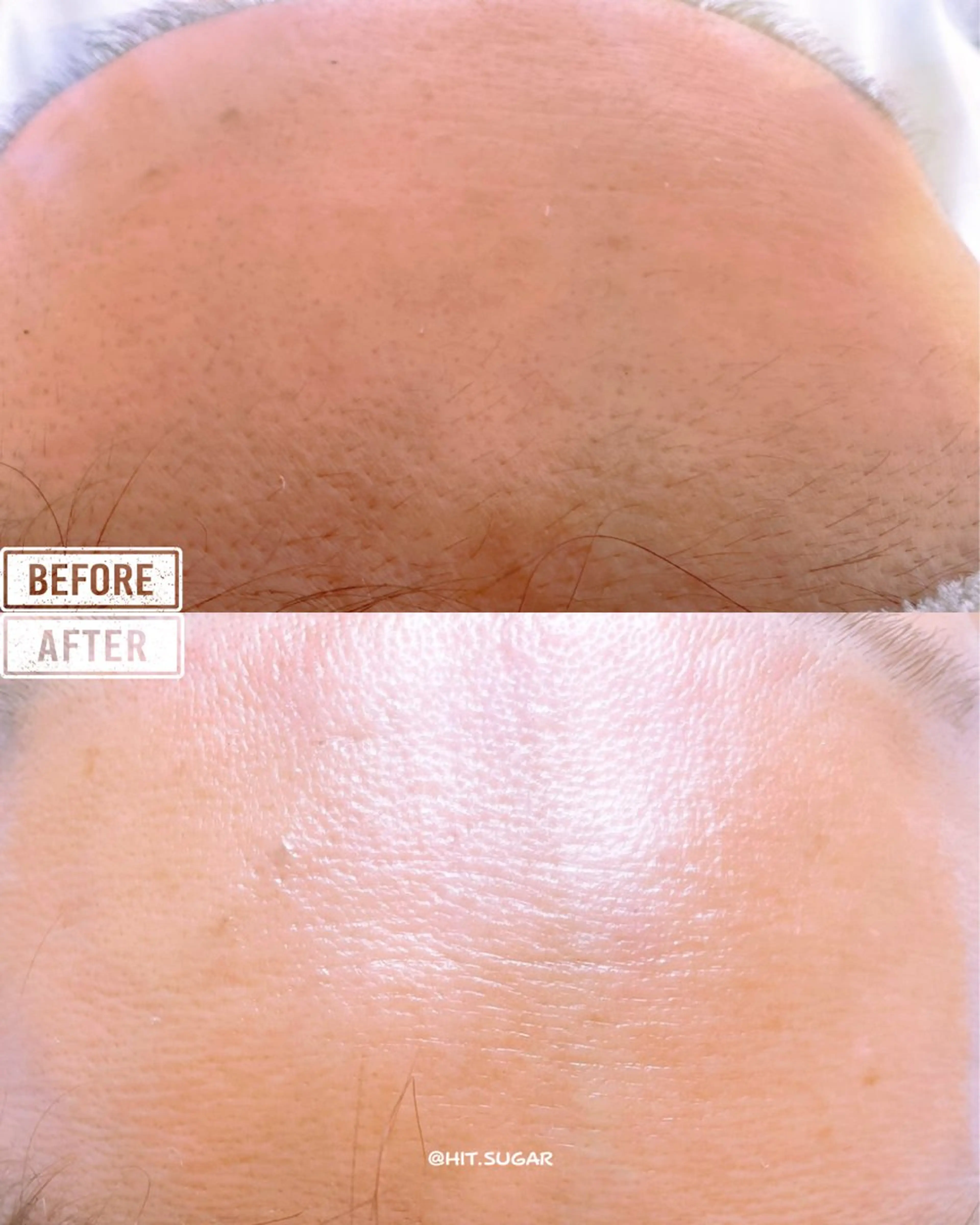 Hit. シュガーリング豊橋のエステ・リラクイメージ