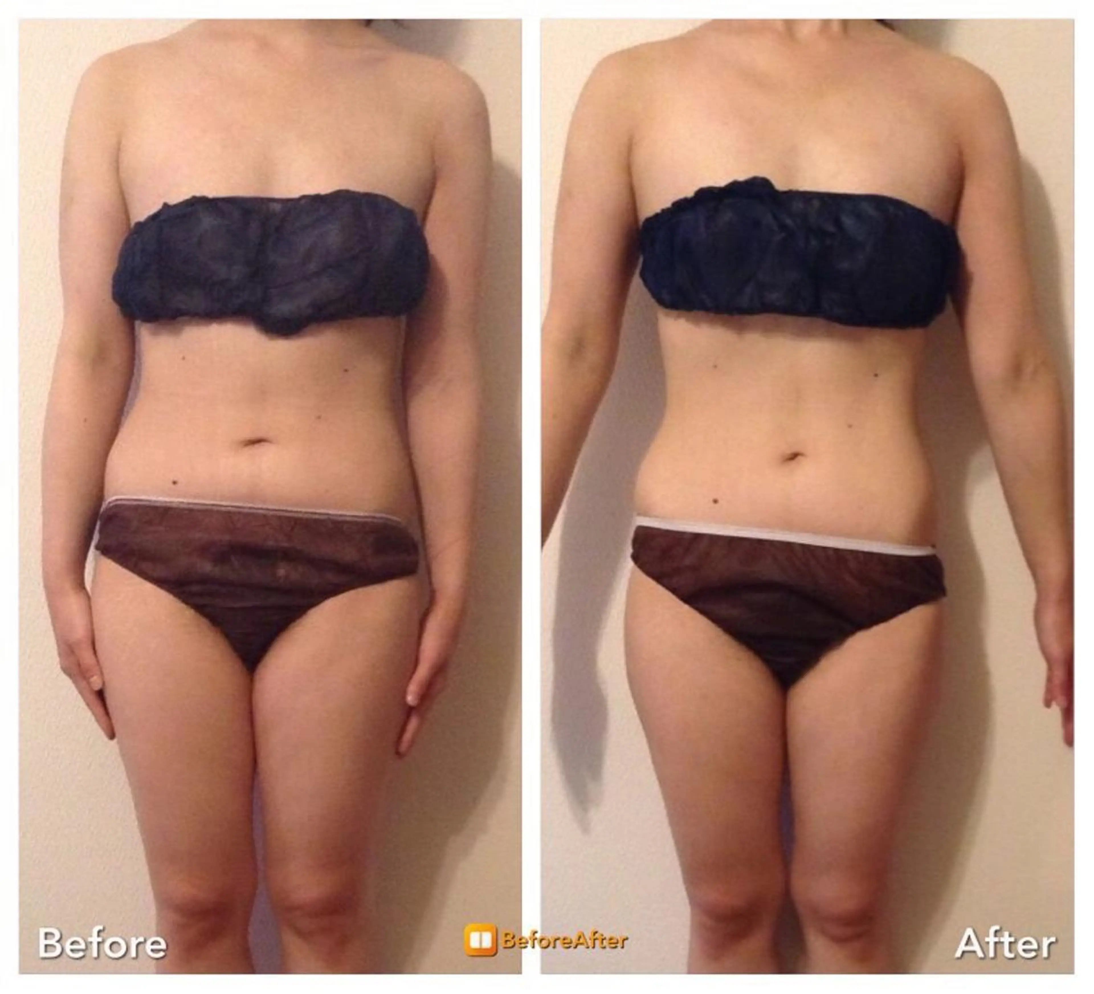 小尻・太もも痩せる エステルナボーテのエステ・リラクイメージ