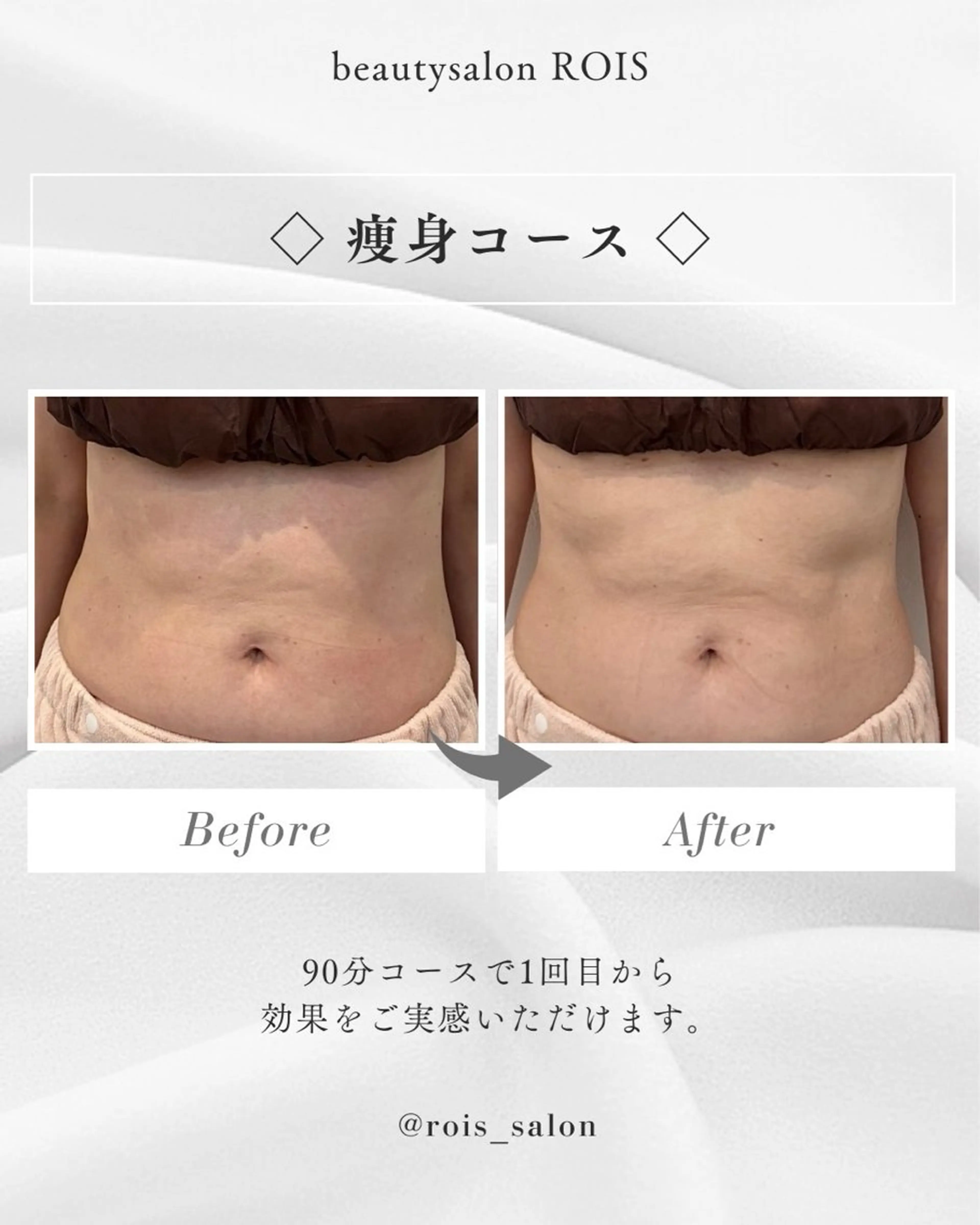 筋膜リペア痩身【フルコース】の写真