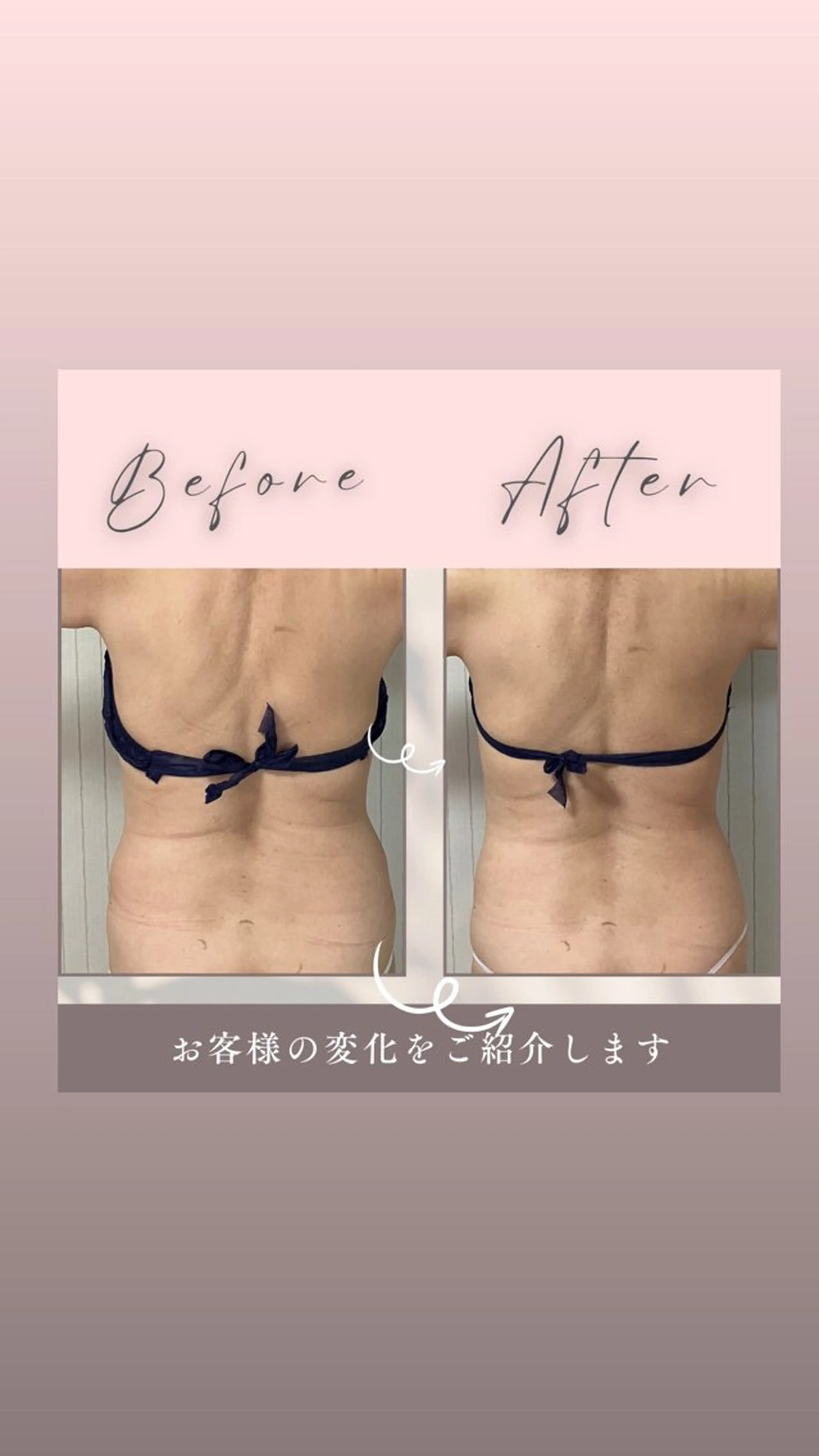 エステ akua... 【肌質管理専門】のその他イメージ