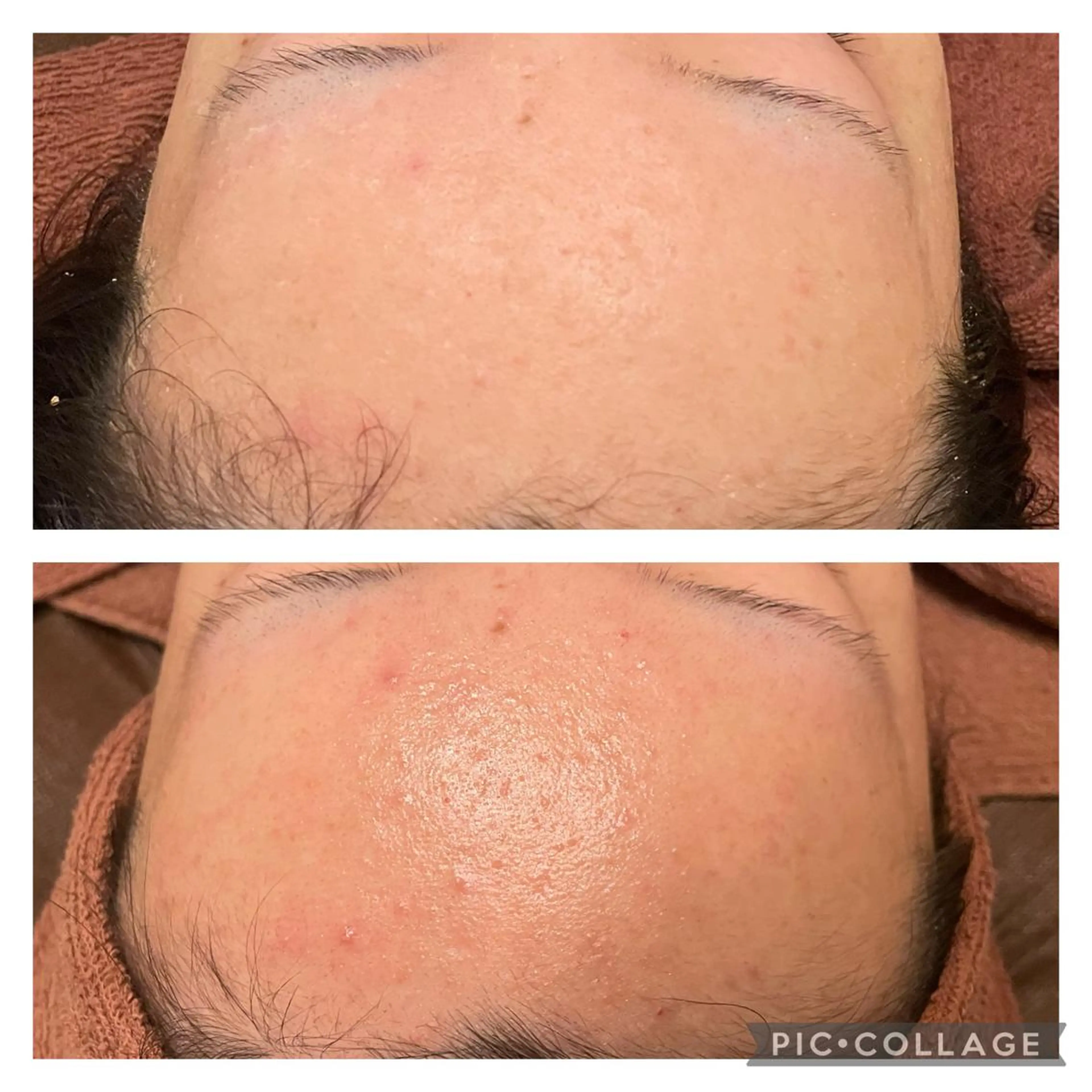 セミロング カラー パーマ ヘアアレンジ メンズ キッズ ネイル マツエク・マツパ アイブロウ ニキビ特化型エステ 🍓最短で肌質改善のその他イメージ