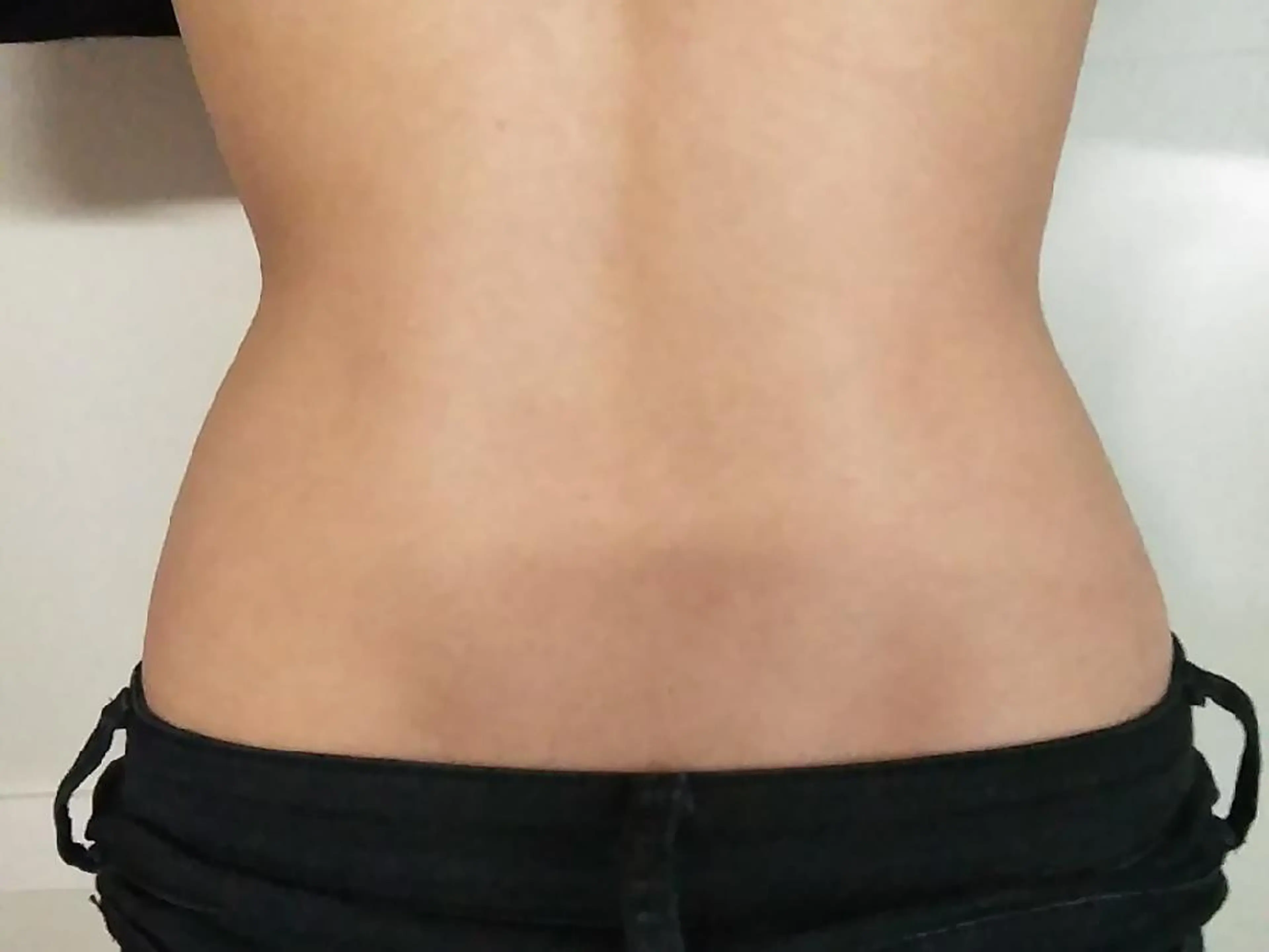 minimo限定❗【骨盤矯正＋ウエストスリム】１回でも即実感できるセット施術です。の写真