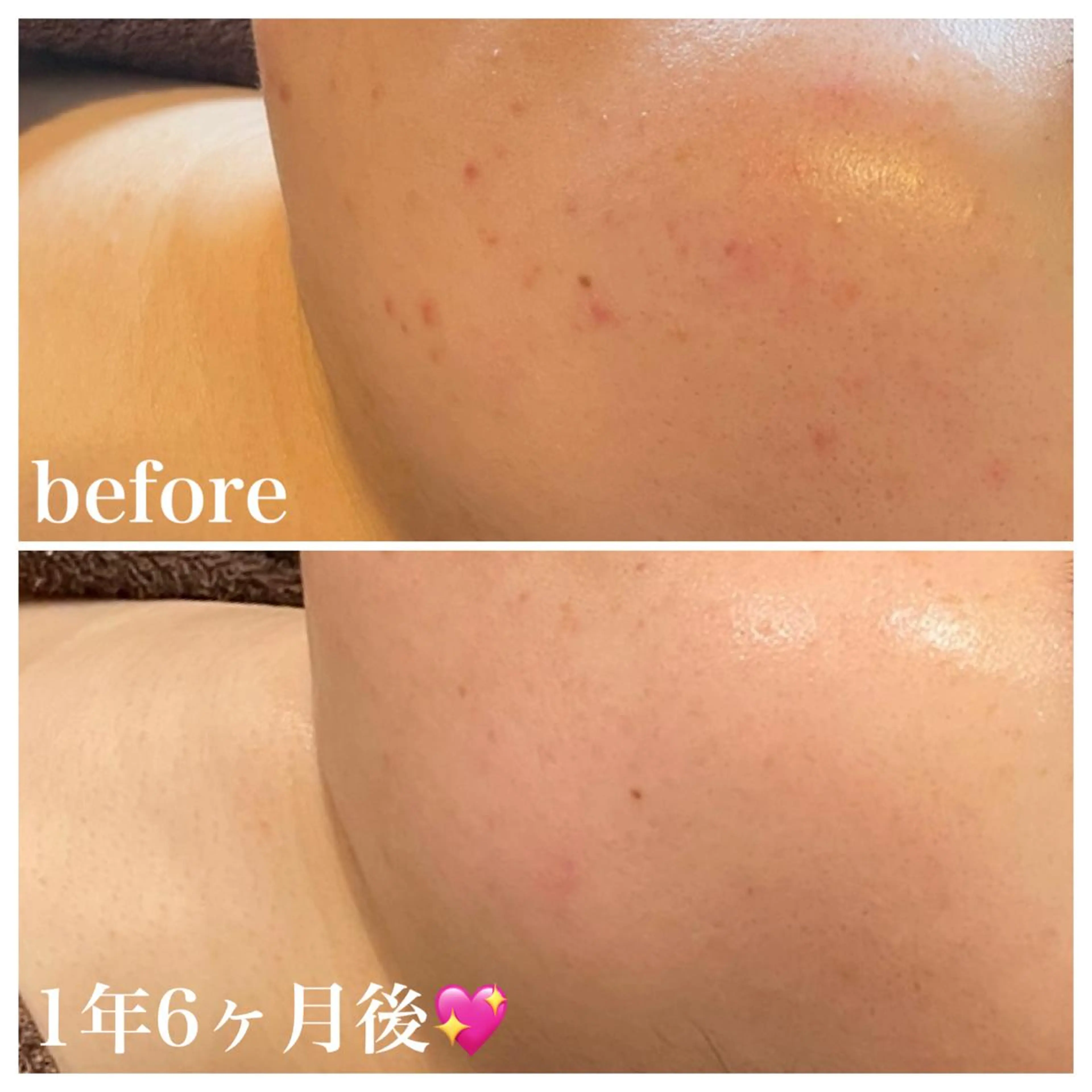 エステ 浜野 恵美のエステ・リラクイメージ