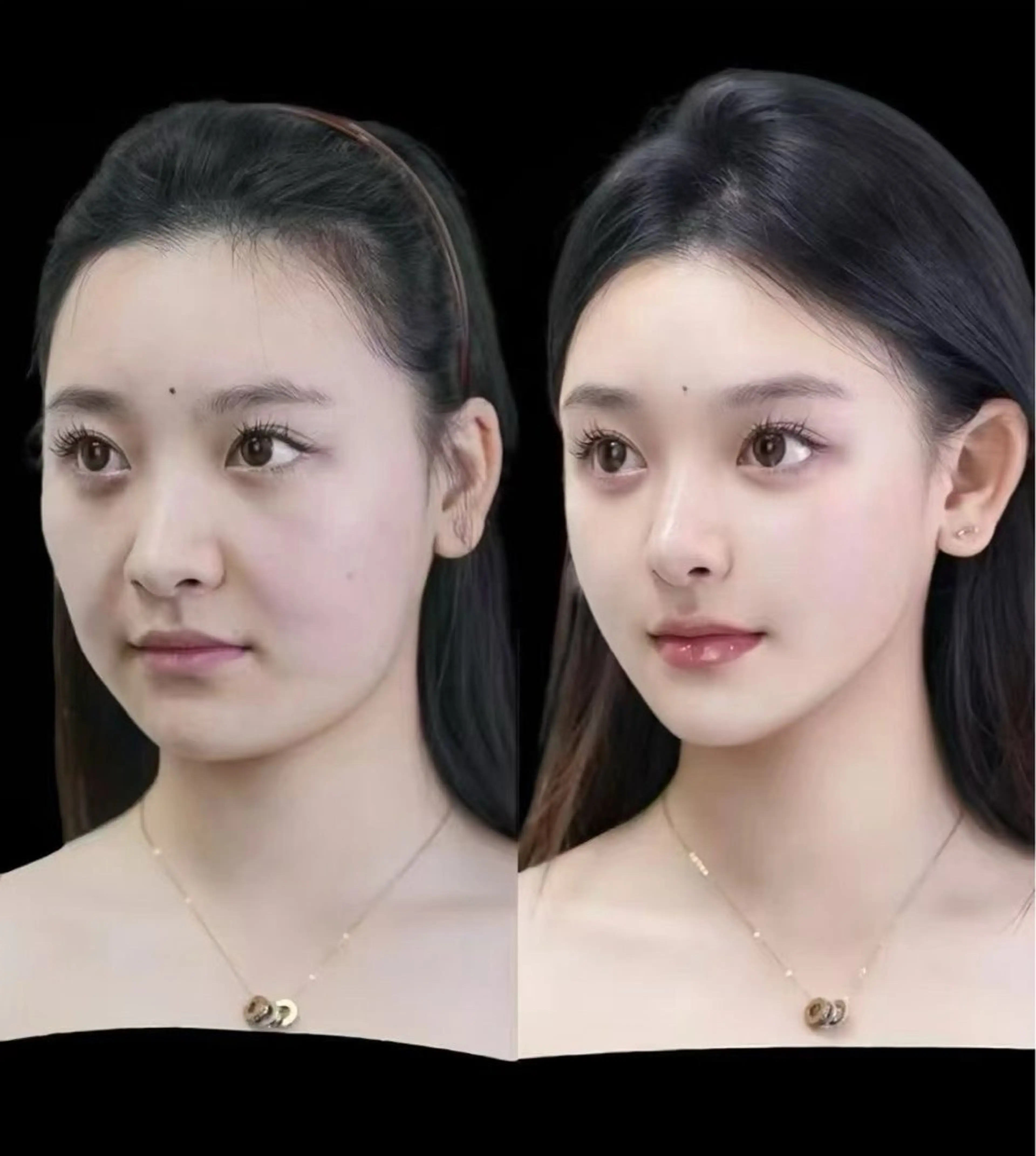 マツエク・マツパ エステ aliaハイフ&水光ジェットサロン所属・aliaハーブ水光店 エステティシャン募集のエステ・リラクイメージ