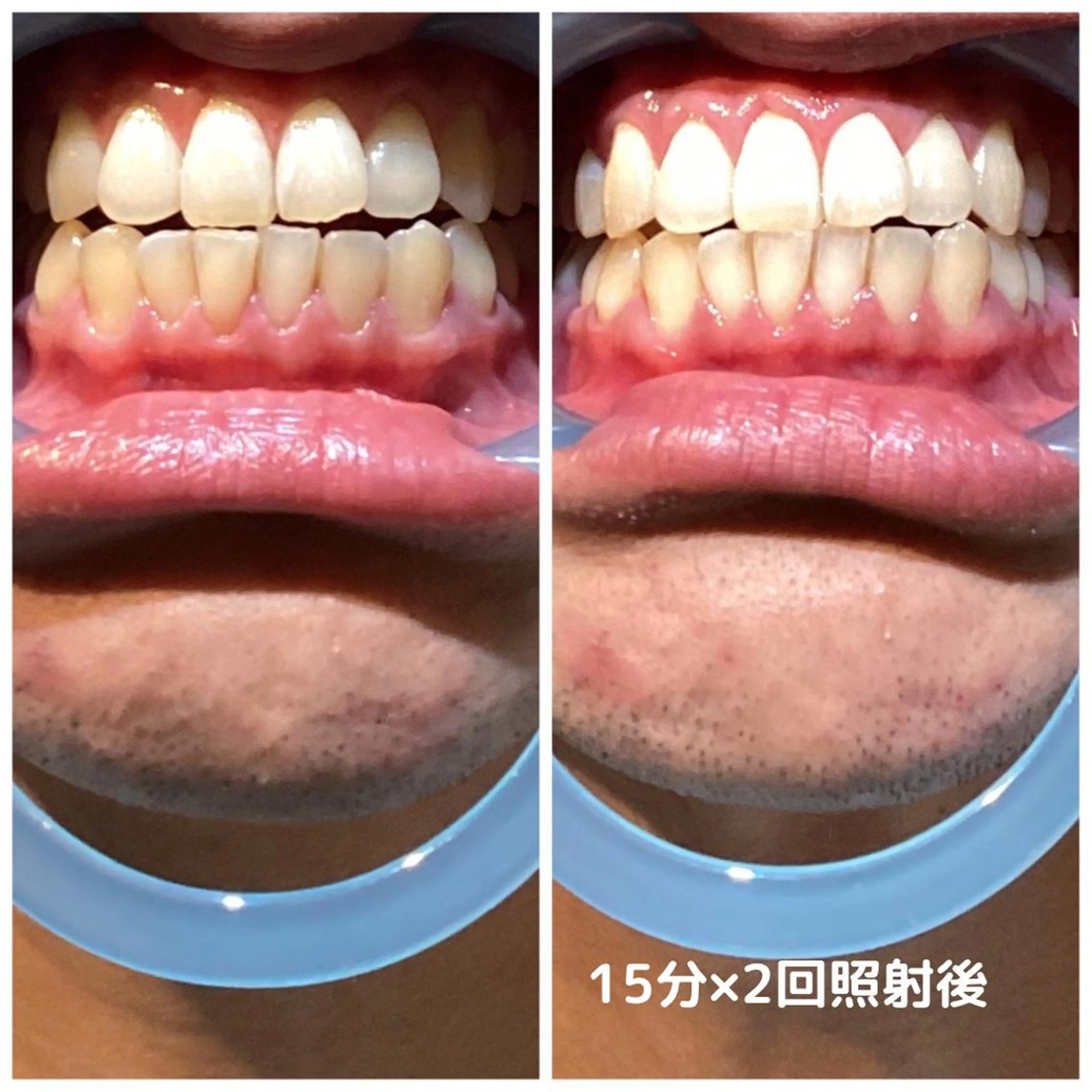 メンズ脱毛ECXIA所属・men's脱毛サロン ECXIAのエステ・リラクイメージ