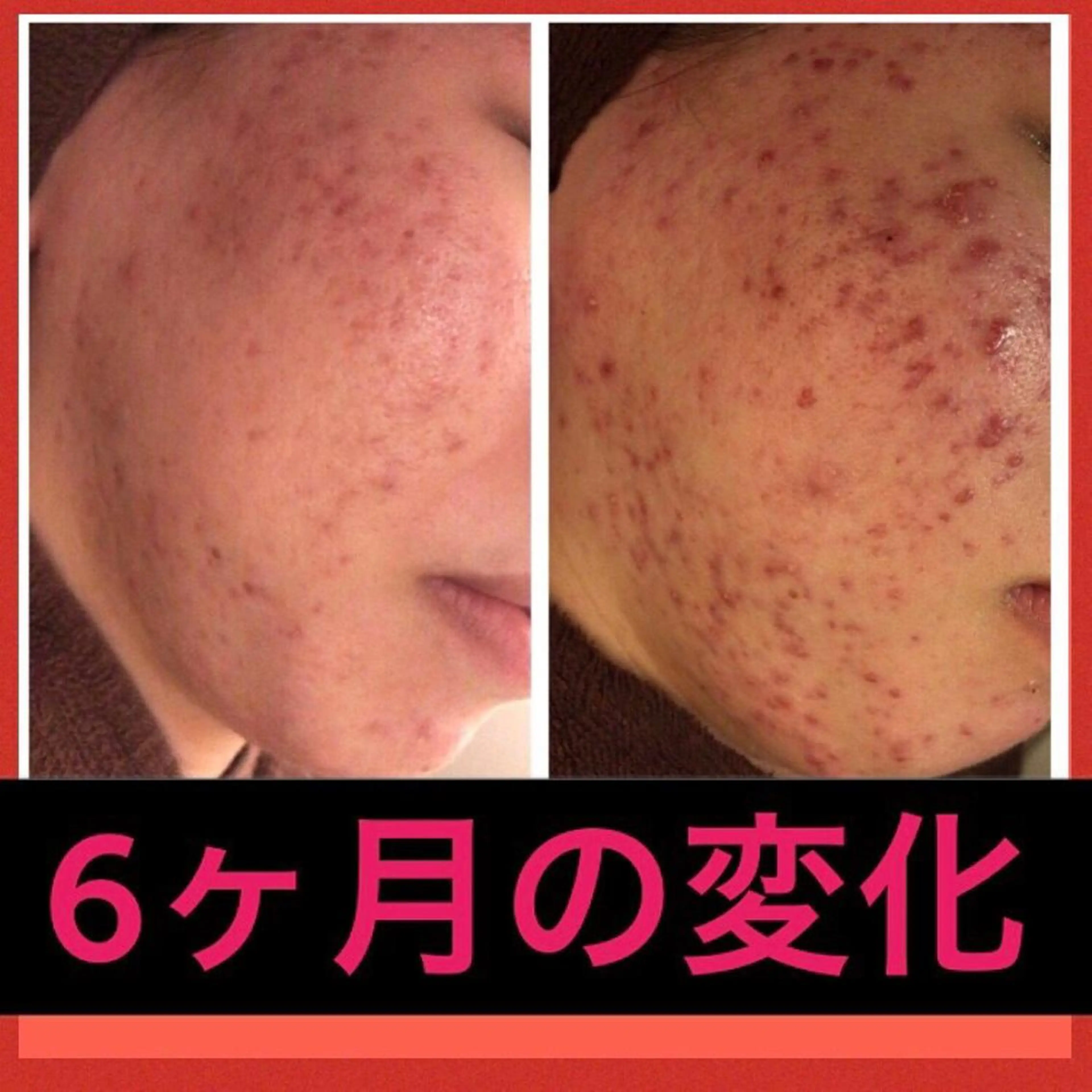 ミディアム カラー パーマ ヘアアレンジ メンズ キッズ ネイル マツエク・マツパ ニキビ・肌質改善専門 ♡人生が変わるサロンのエステ・リラクイメージ