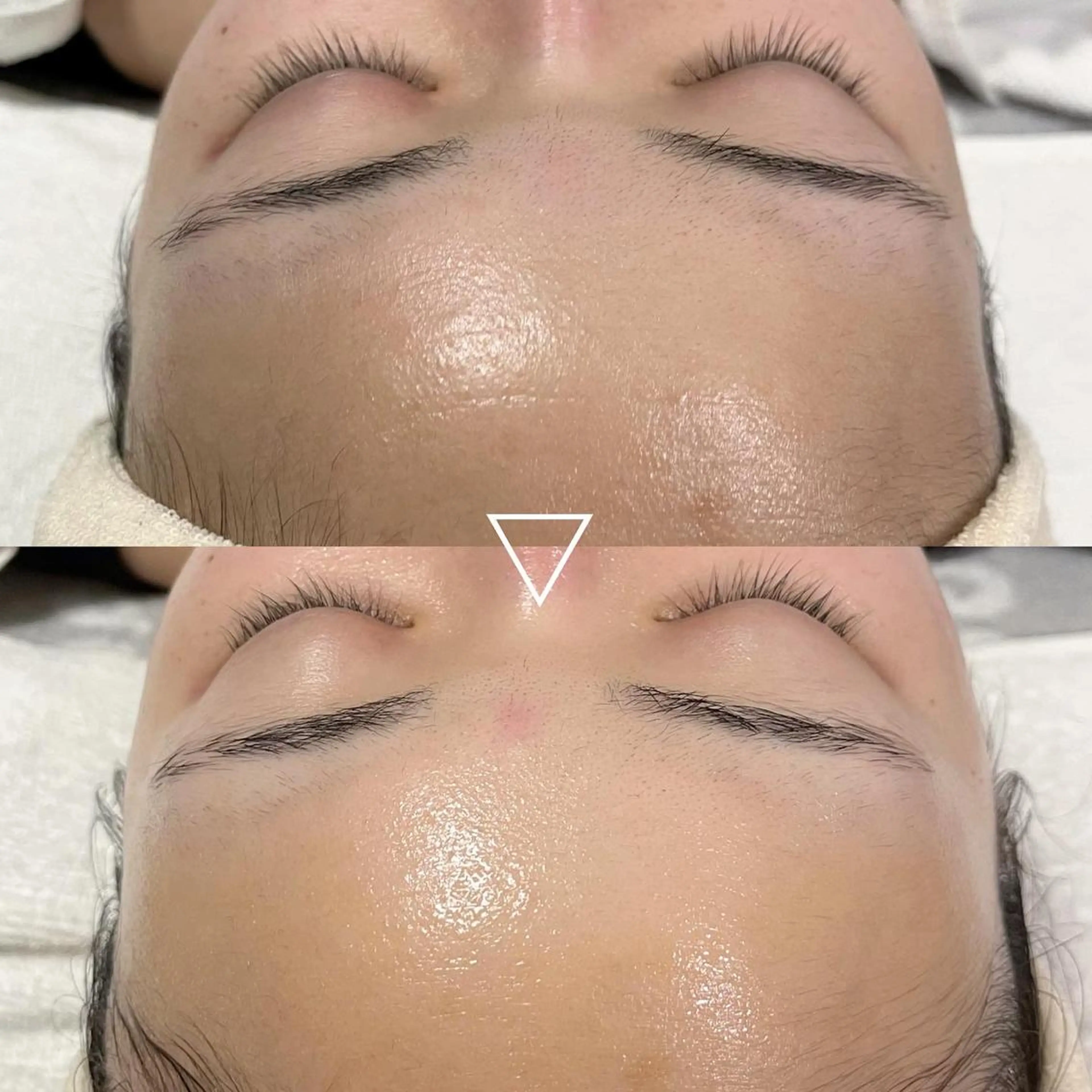 【ご新規様限定】【モニター】肌質改善フェイシャルエステの写真