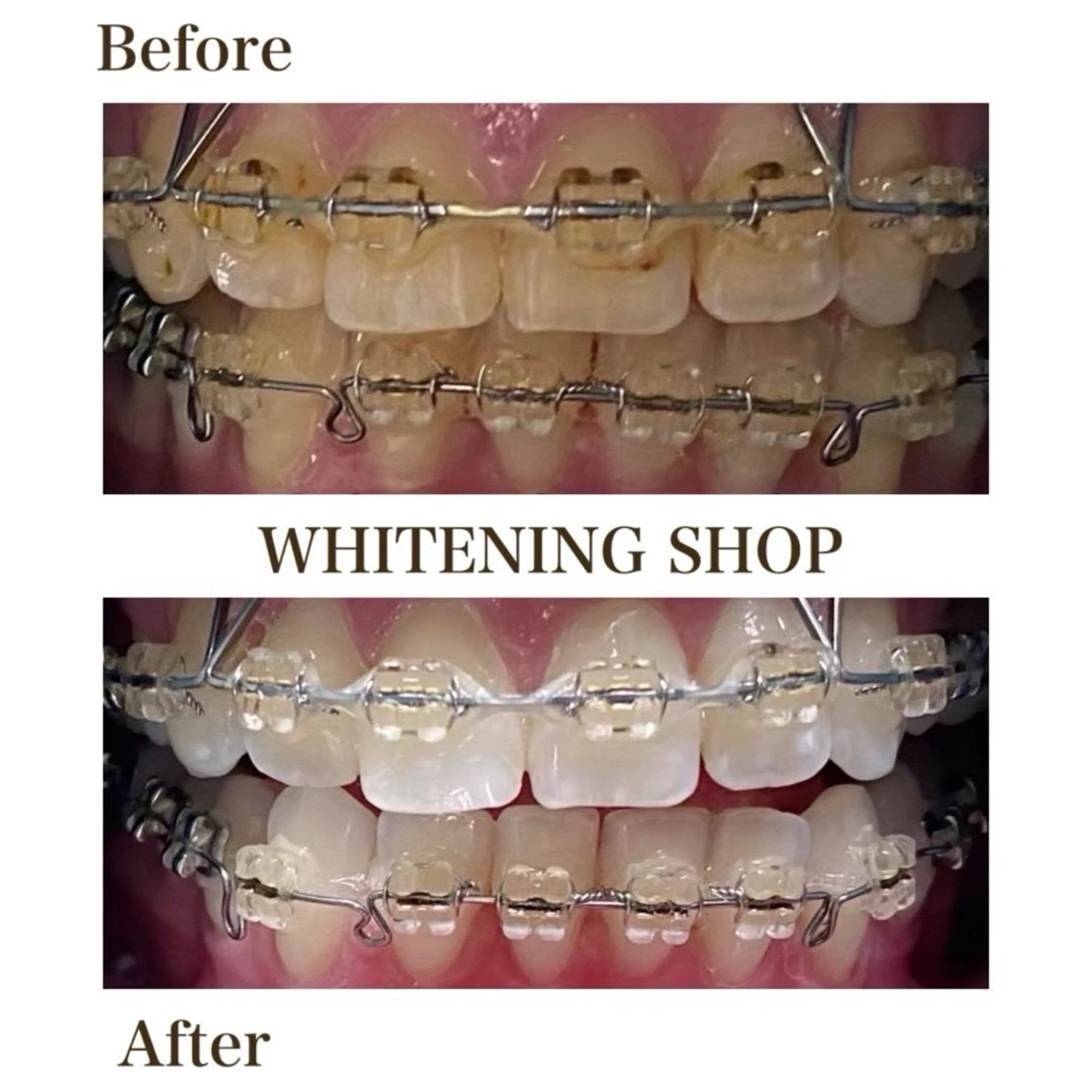 その他 ホワイトニングショップ津店所属・ホワイトニング ショップ津店のその他イメージ