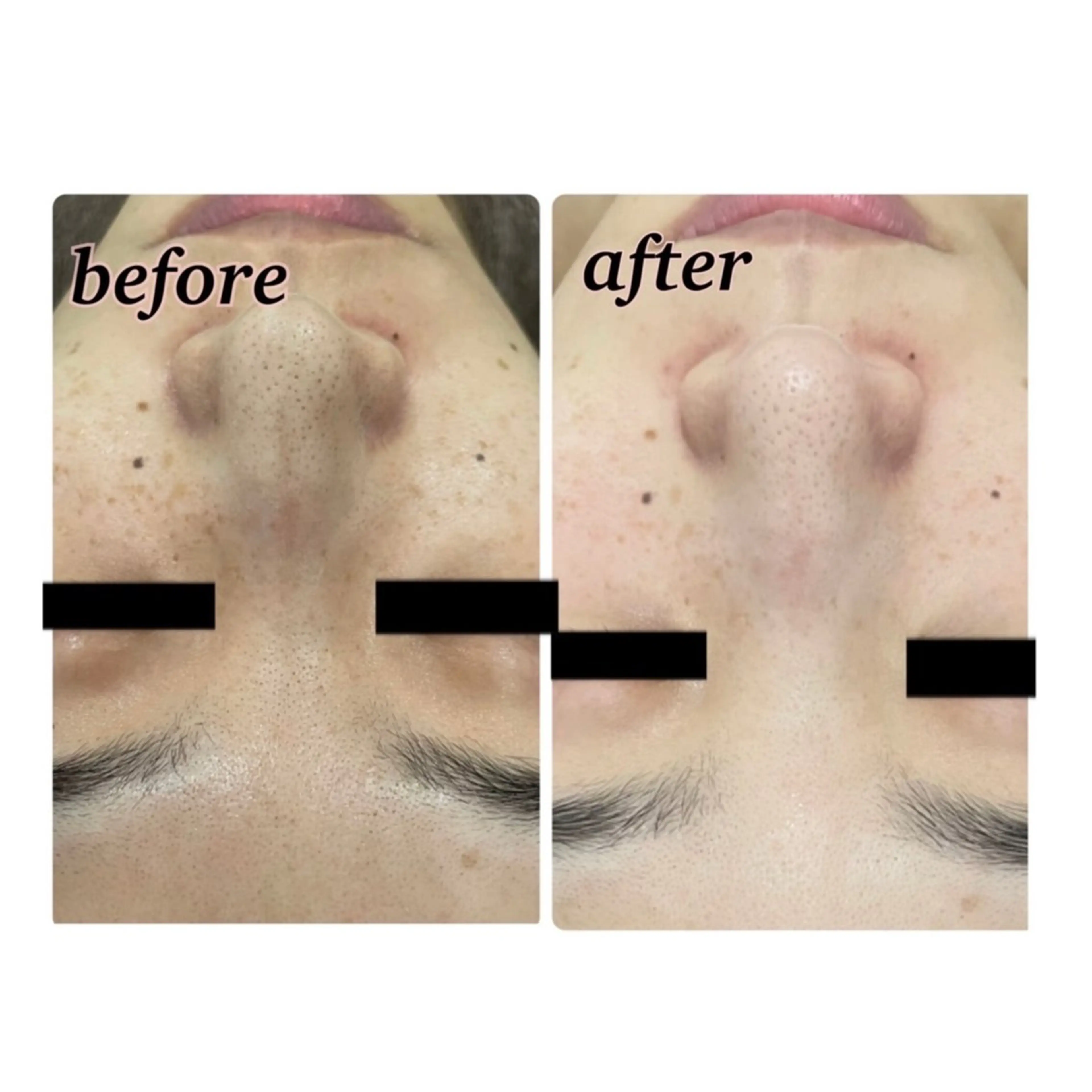 【folche】 フジイのエステ・リラクイメージ