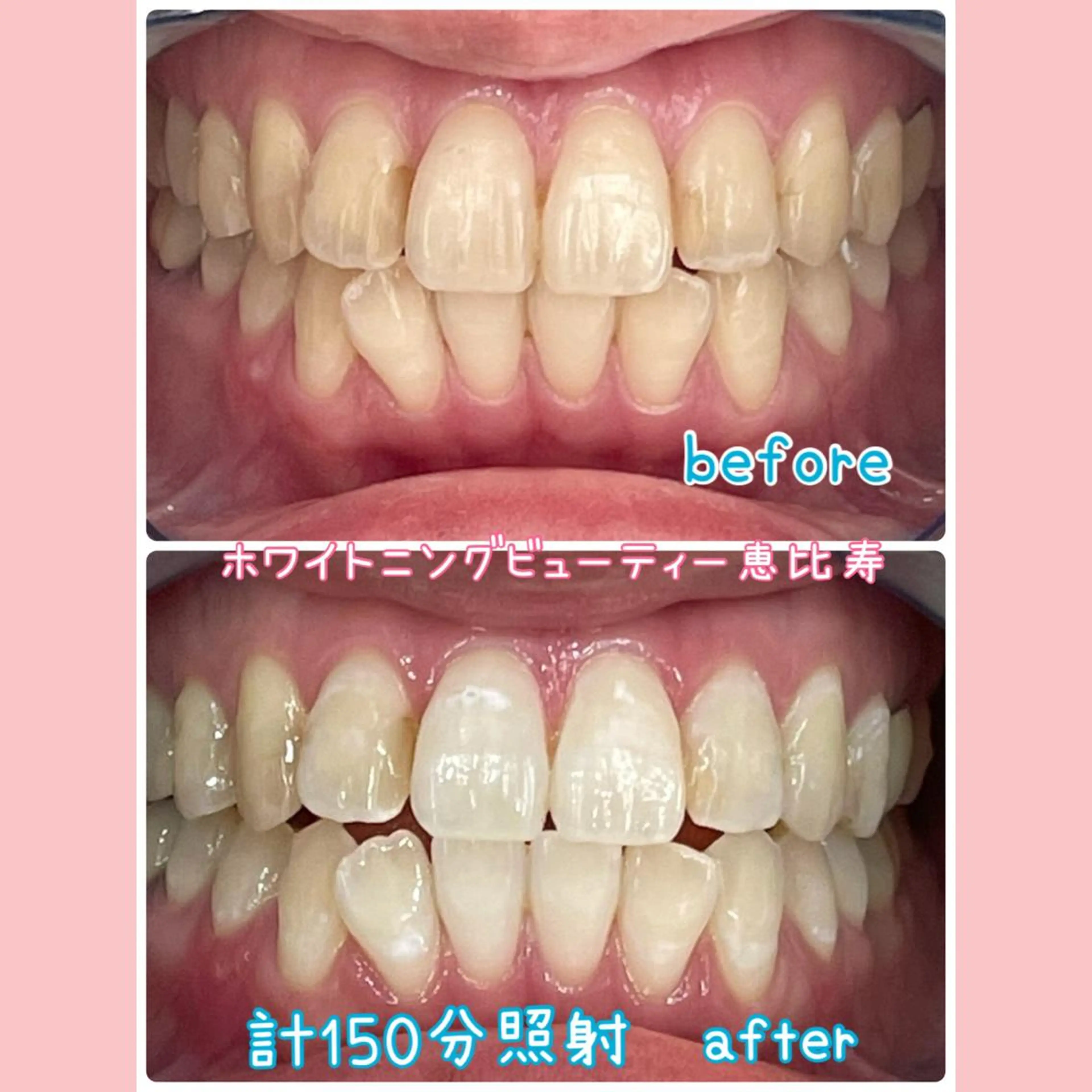 エステ リラク EMINAL恵比寿 HITOMIのエステ・リラクイメージ