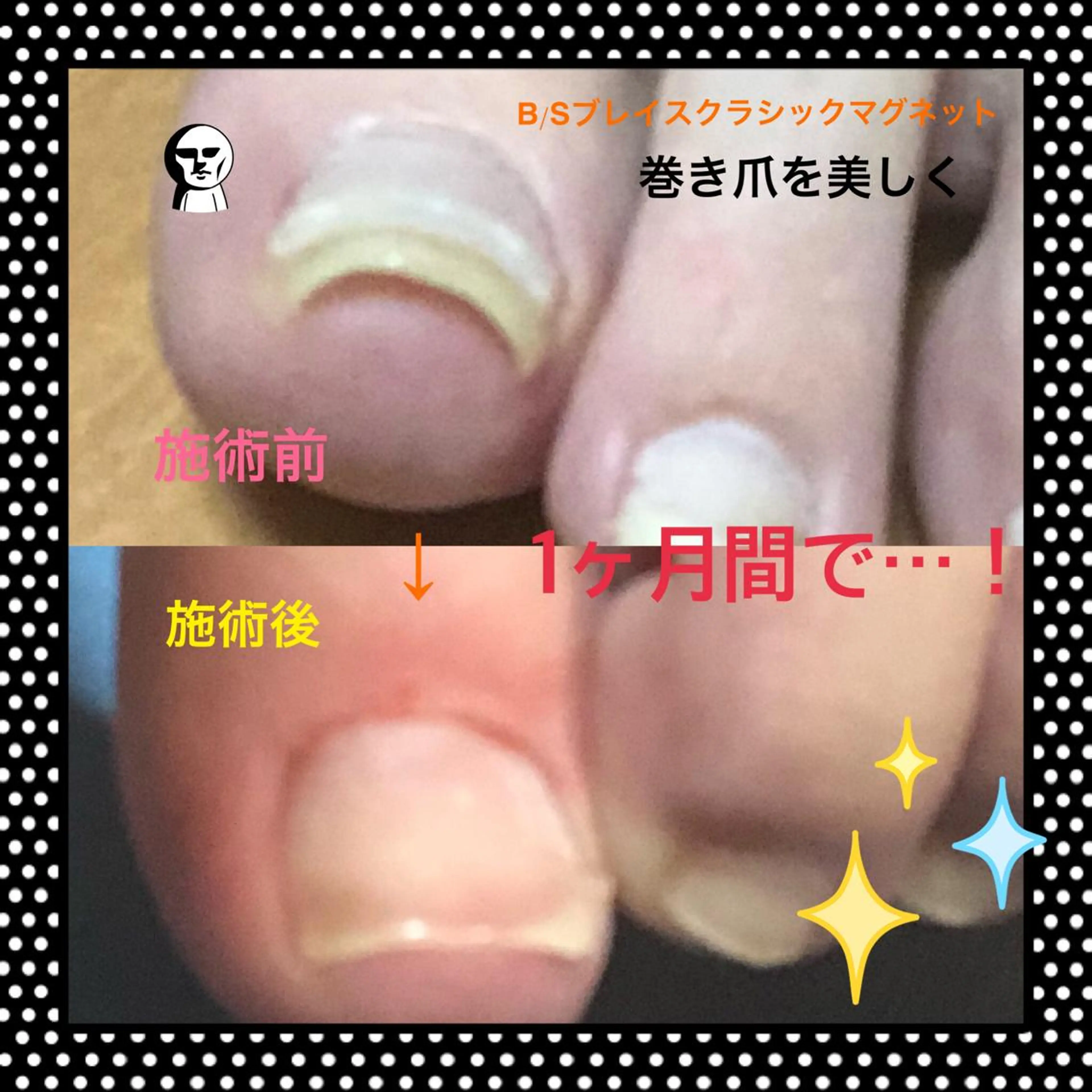 ネイル u sのネイルデザイン