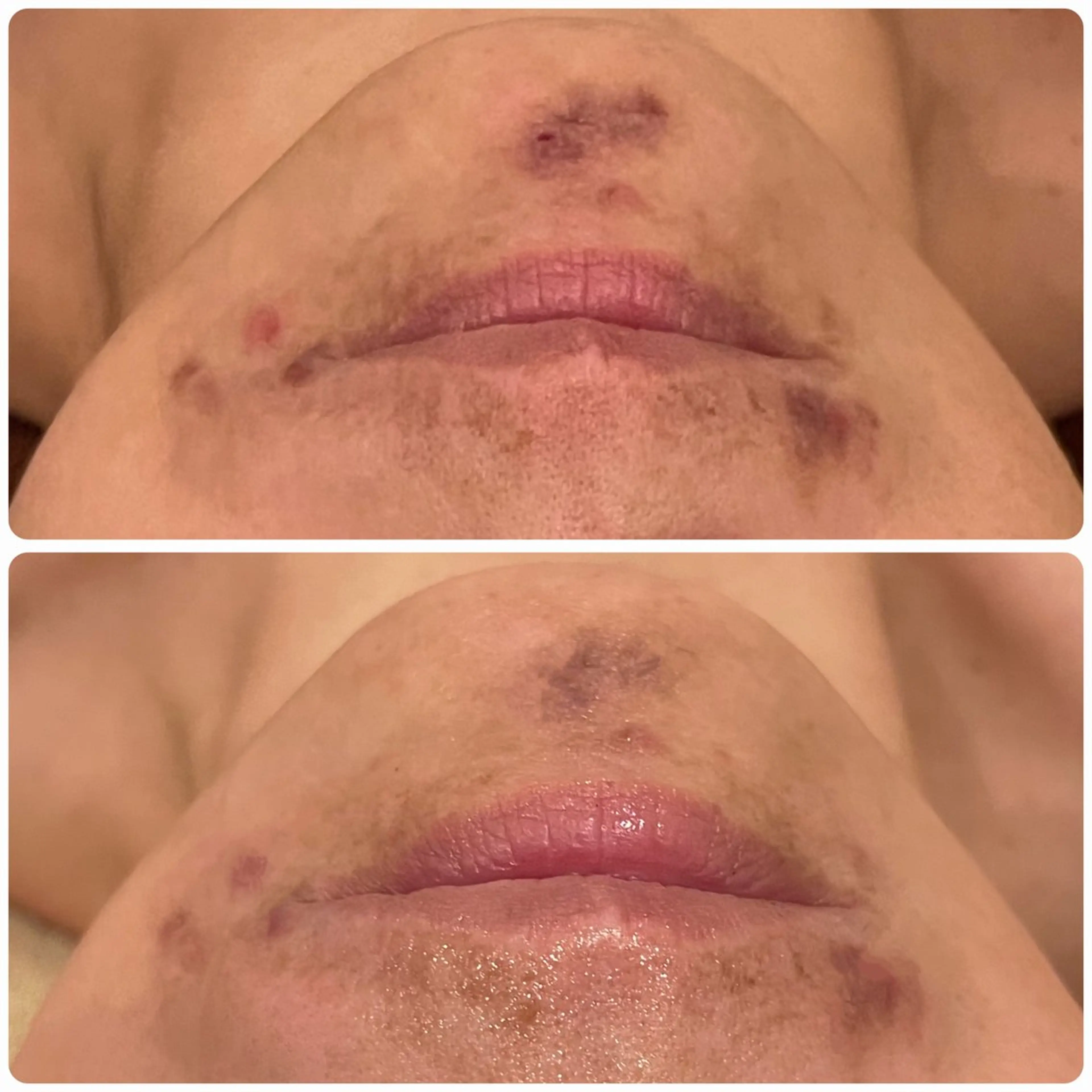 立体小顔×艶肌×美ボ ディ似合わせ施術 岡のエステ・リラクイメージ