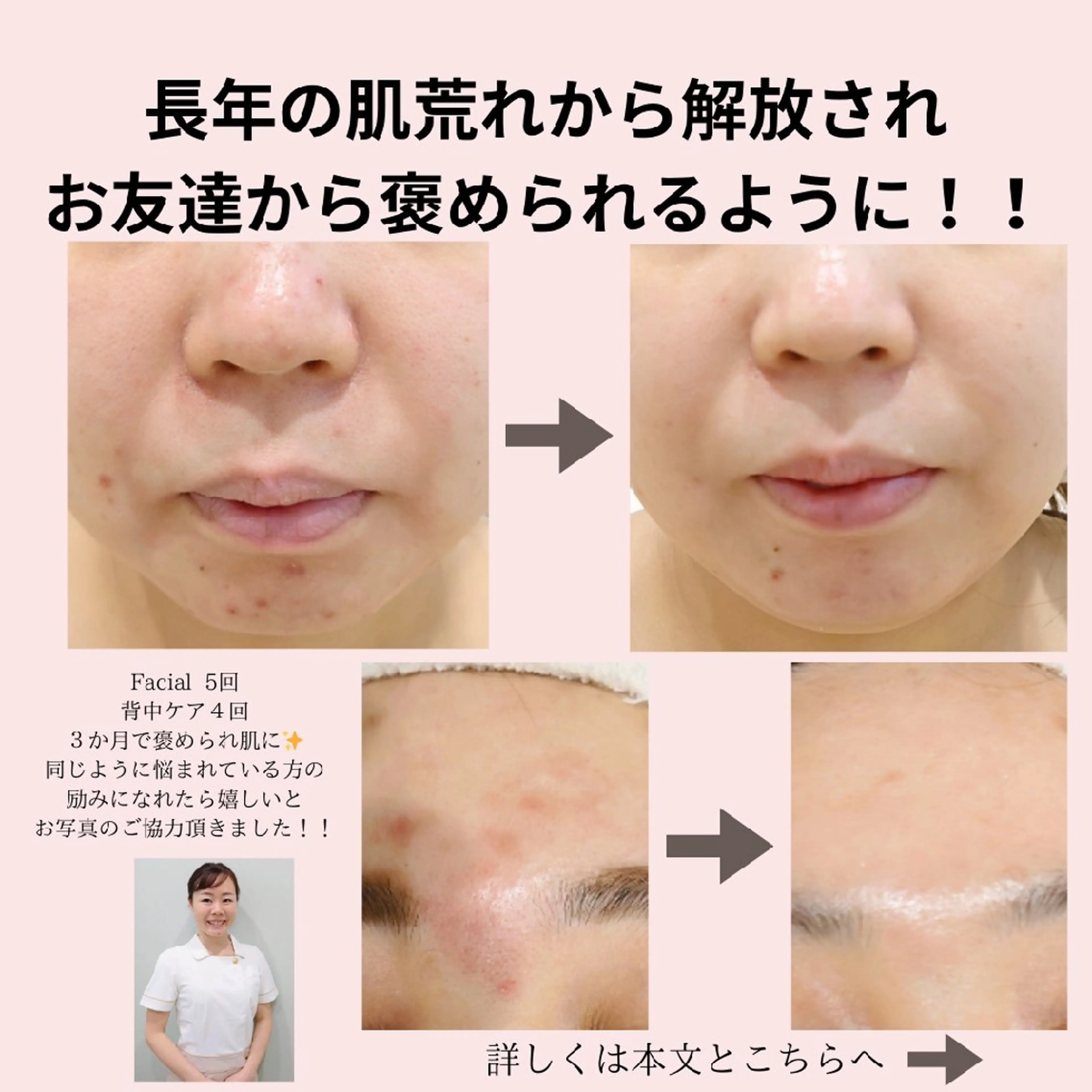 エステ PRETTIEST SHINE所属・山田 浩子のエステ・リラクイメージ