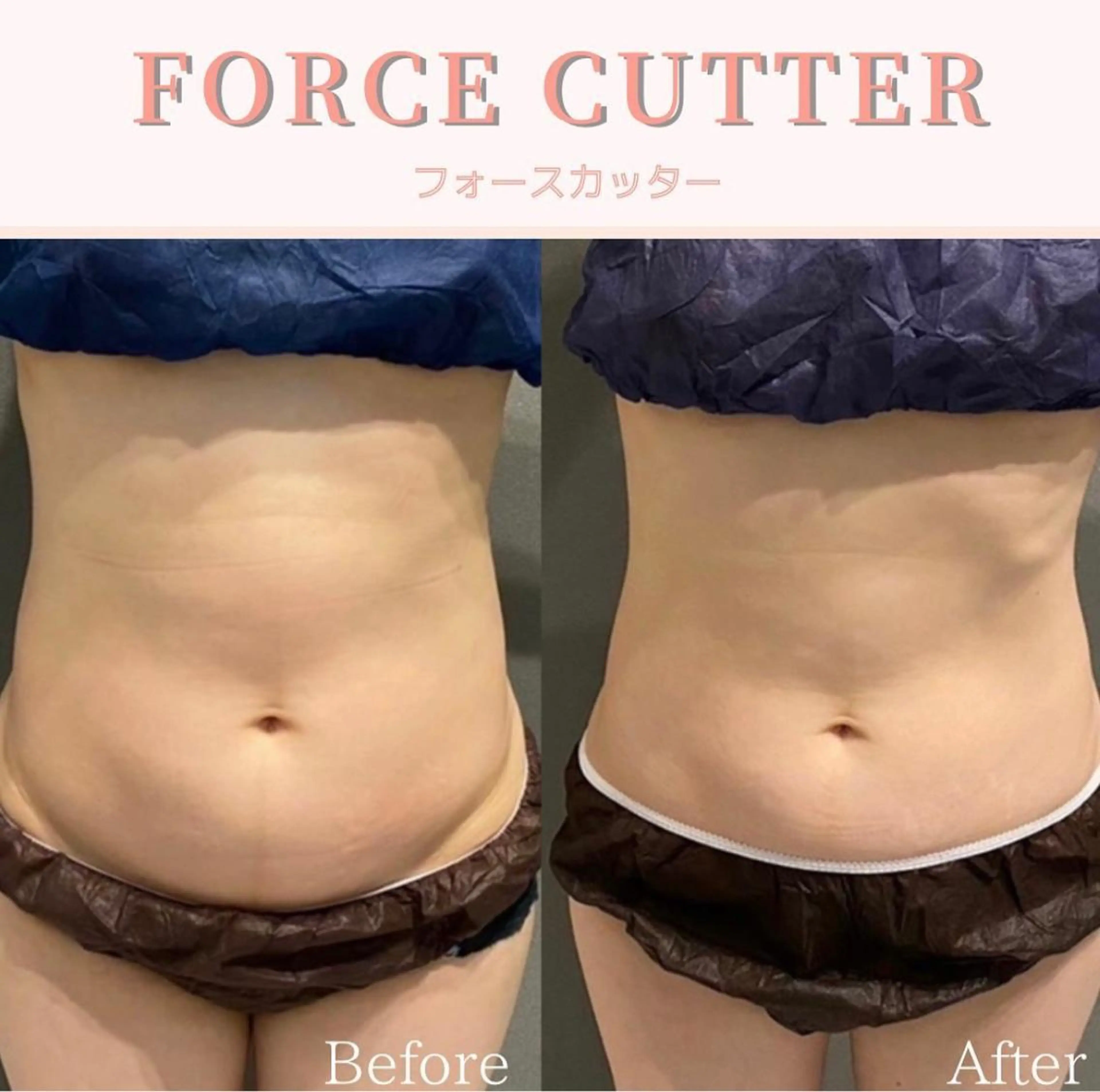 エステ リラク Hu.ruana AWANOのエステ・リラクイメージ