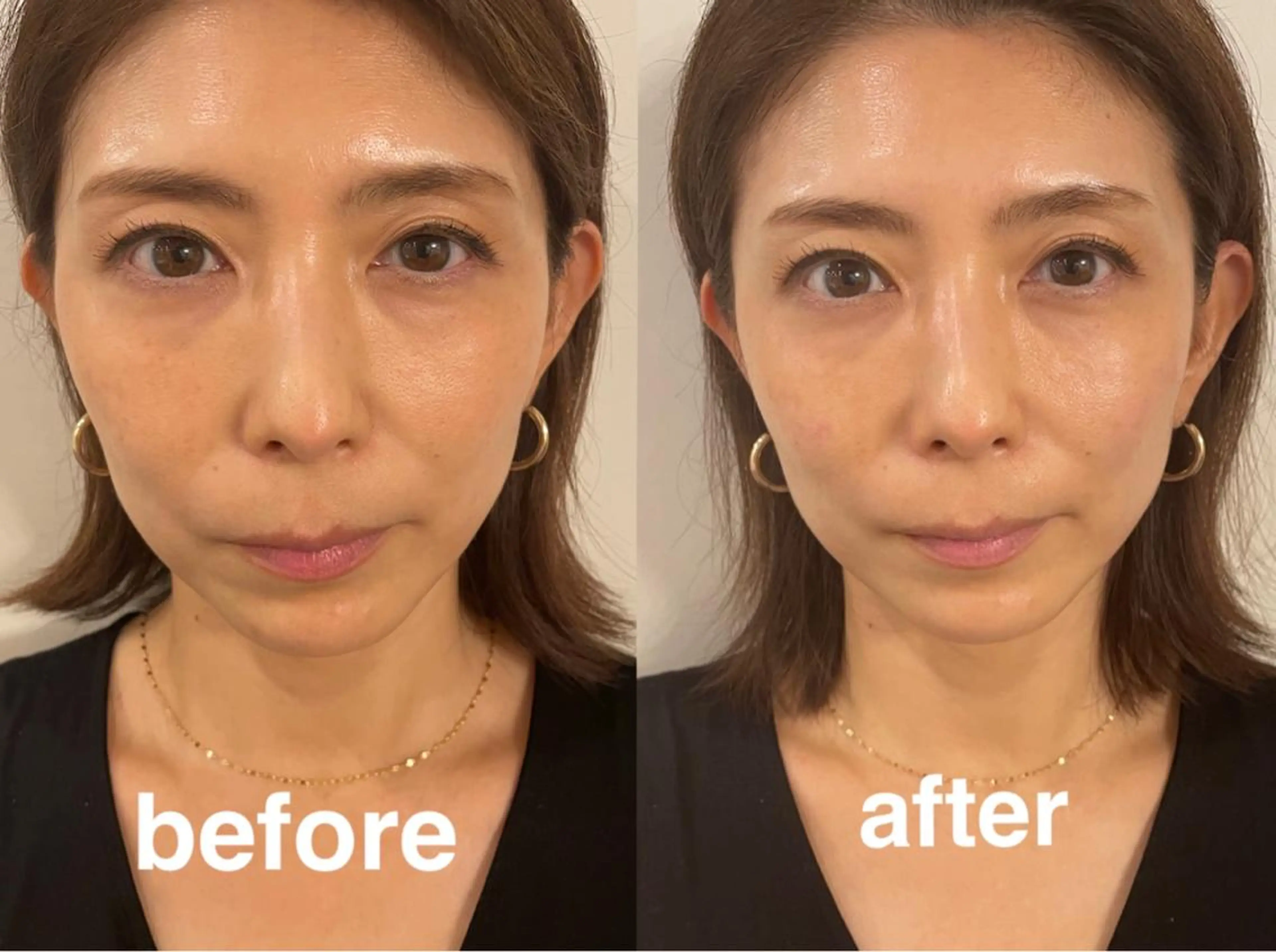 美容鍼灸サロン mahoroba院長のエステ・リラクイメージ