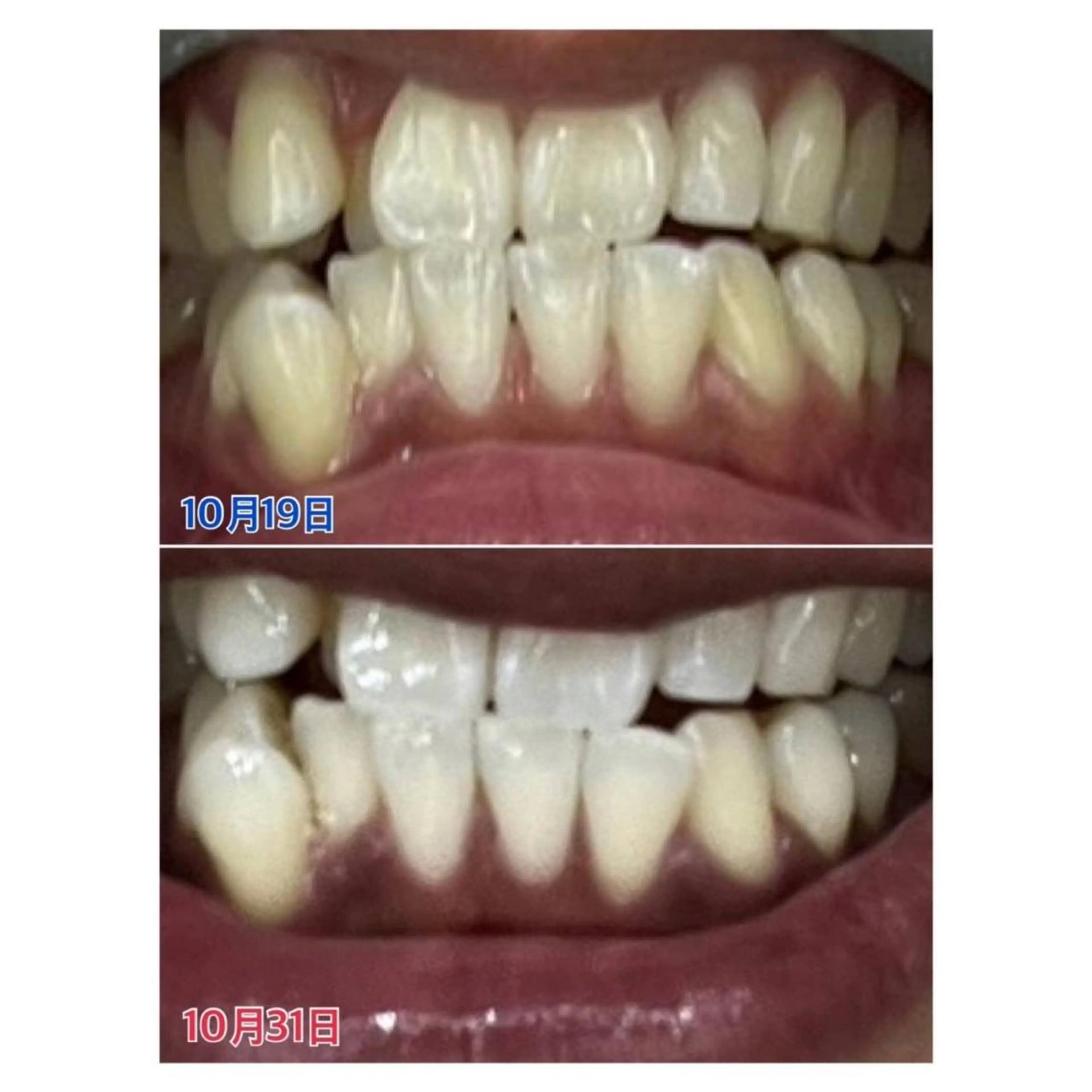 MBEAUTYSALON 千葉店・京成大久保所属・Melty 輝のその他イメージ